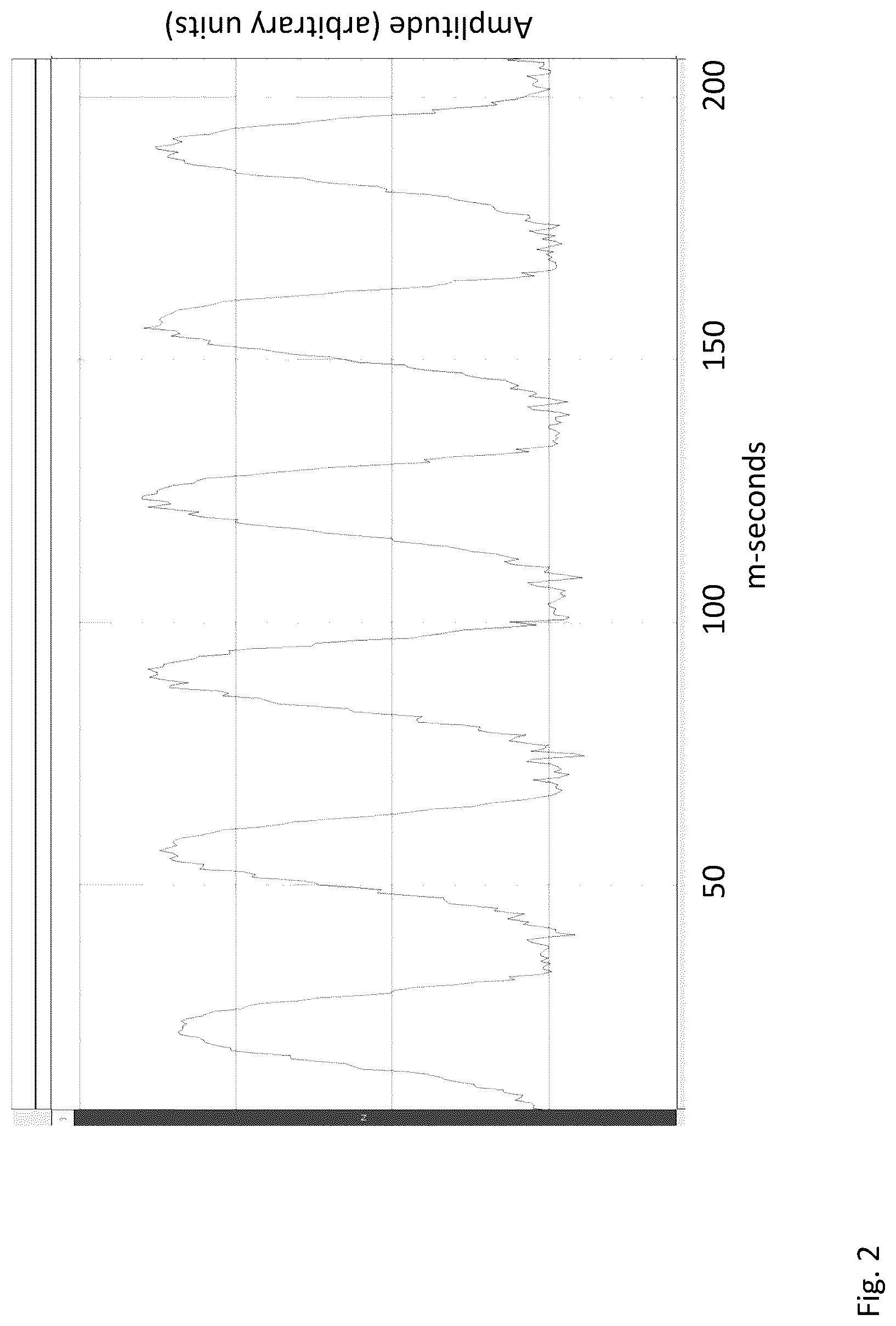 Patent US12097163 Figure 4 – Vibration producing device with sleep cycle function and transducer
