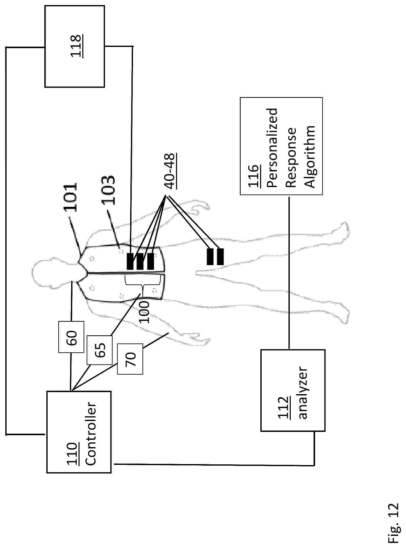 Patent US12097163 Figure 14 – Vibration producing device with sleep cycle function and transducer