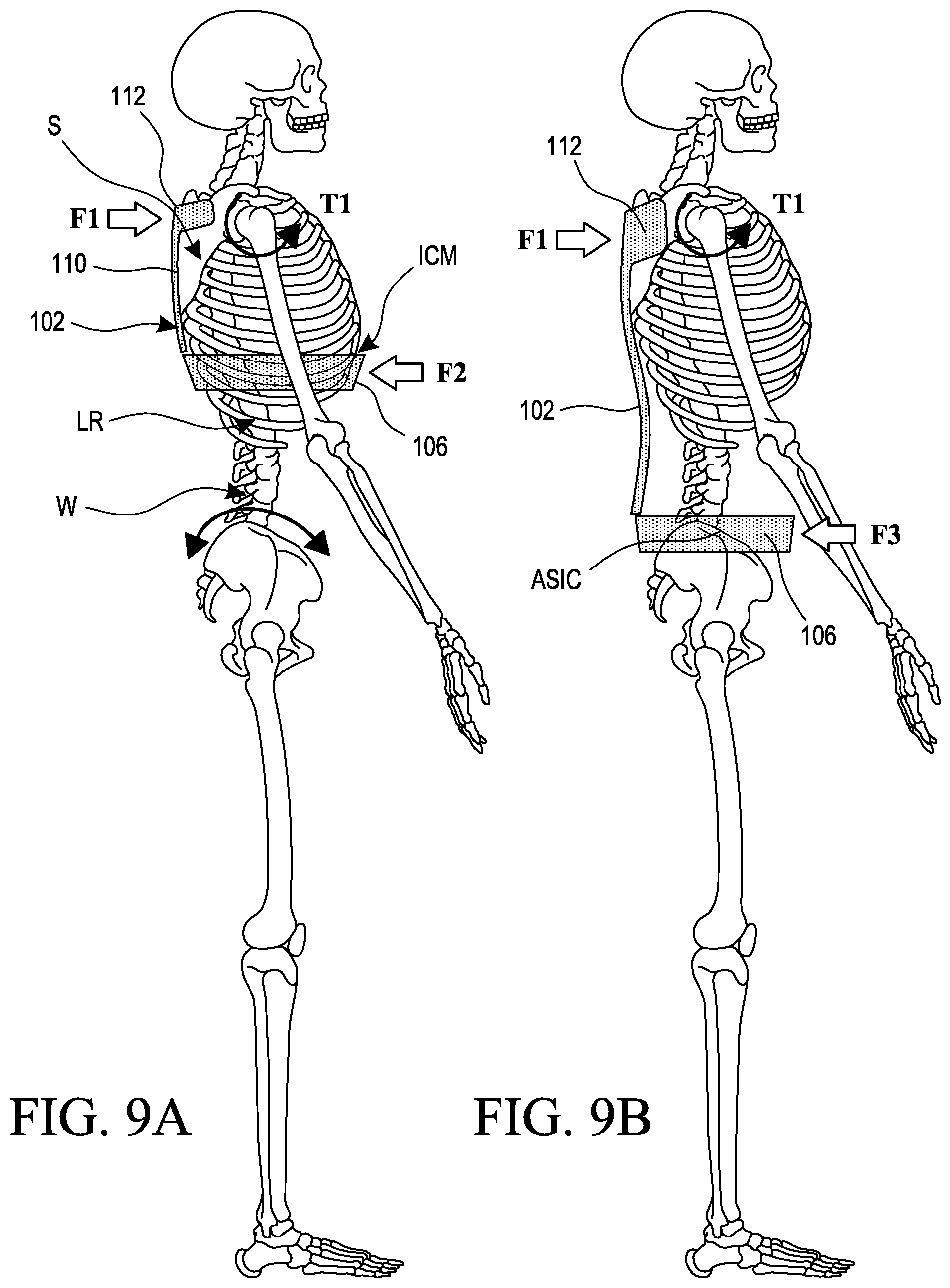 Patent US12097164 Figure 6 – Interface system in an exoskeleton