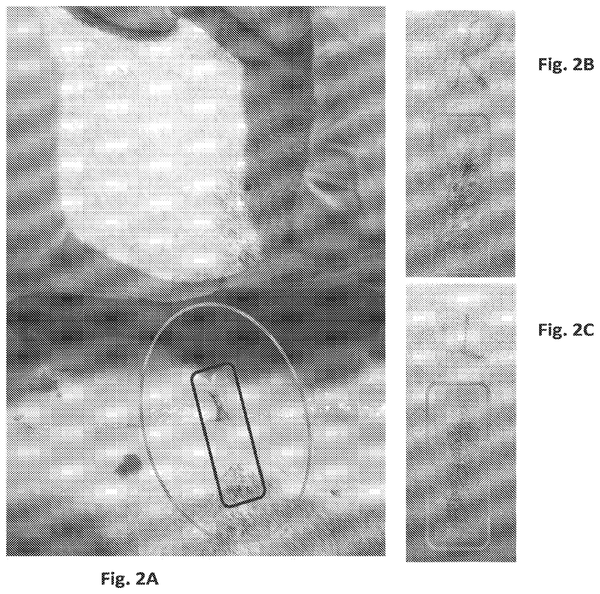 Patent US12097179 Figure 2 – Carbazole derivatives for the treatment of fibrotic diseases and related symptoms, and conditions thereof