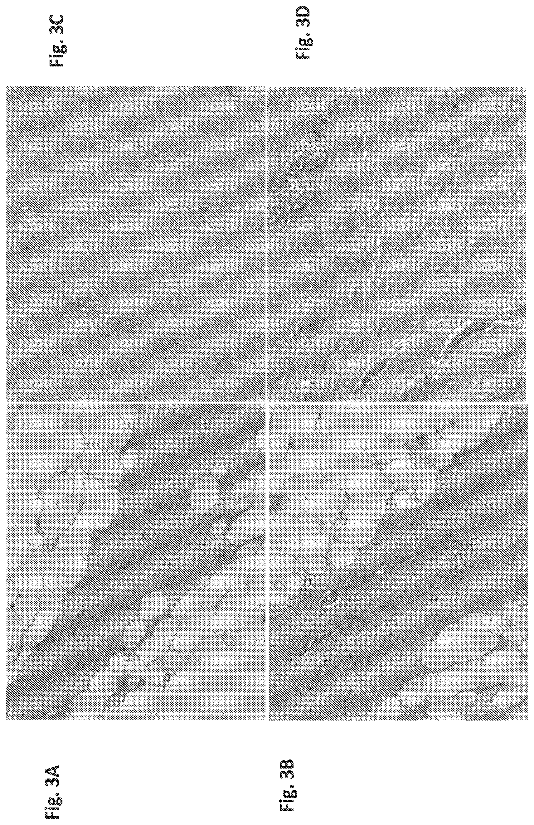 Patent US12097179 Figure 3 – Carbazole derivatives for the treatment of fibrotic diseases and related symptoms, and conditions thereof