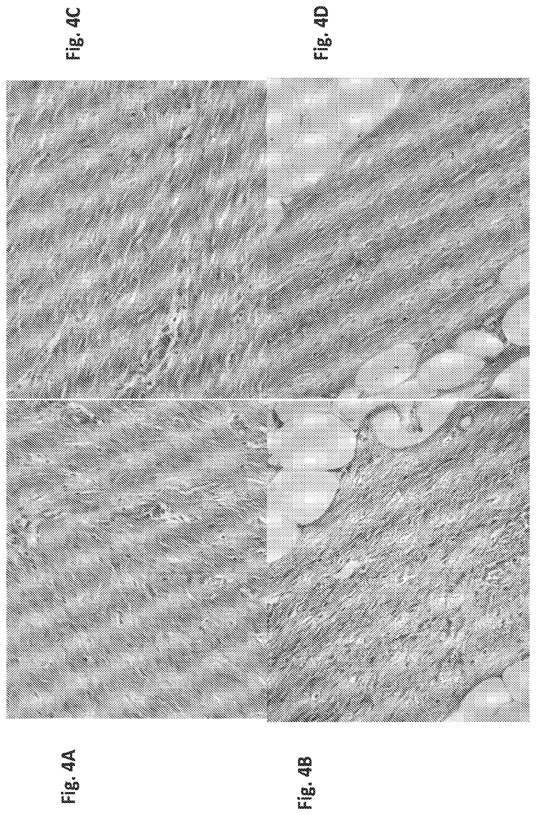 Patent US12097179 Figure 4 – Carbazole derivatives for the treatment of fibrotic diseases and related symptoms, and conditions thereof