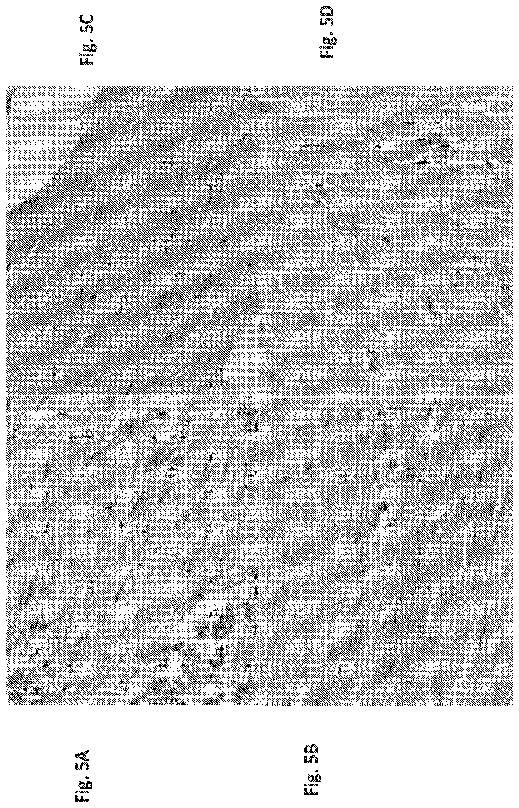 Patent US12097179 Figure 5 – Carbazole derivatives for the treatment of fibrotic diseases and related symptoms, and conditions thereof