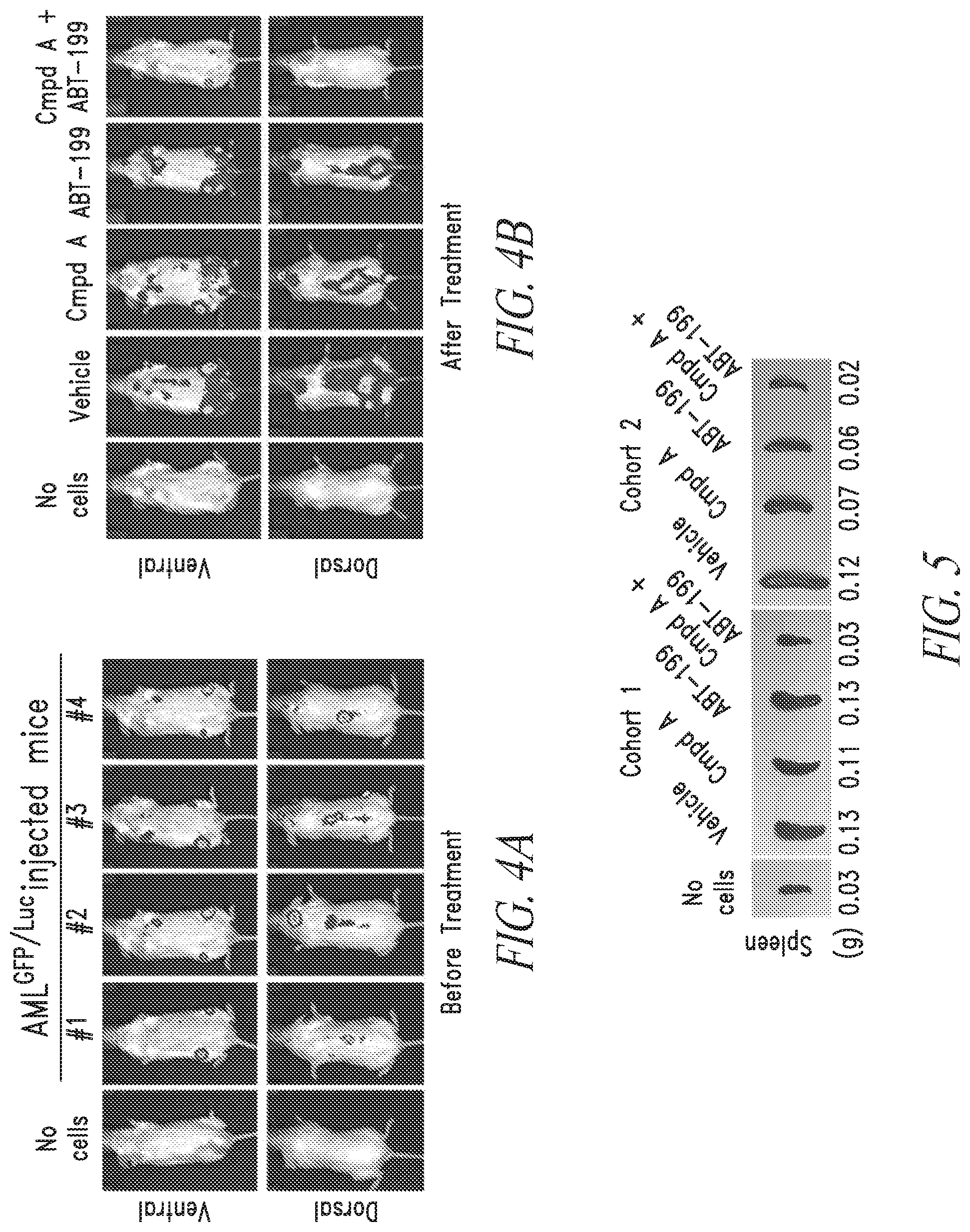 Patent US12097194 Figure 4 – Combination therapy for treating blood cancer