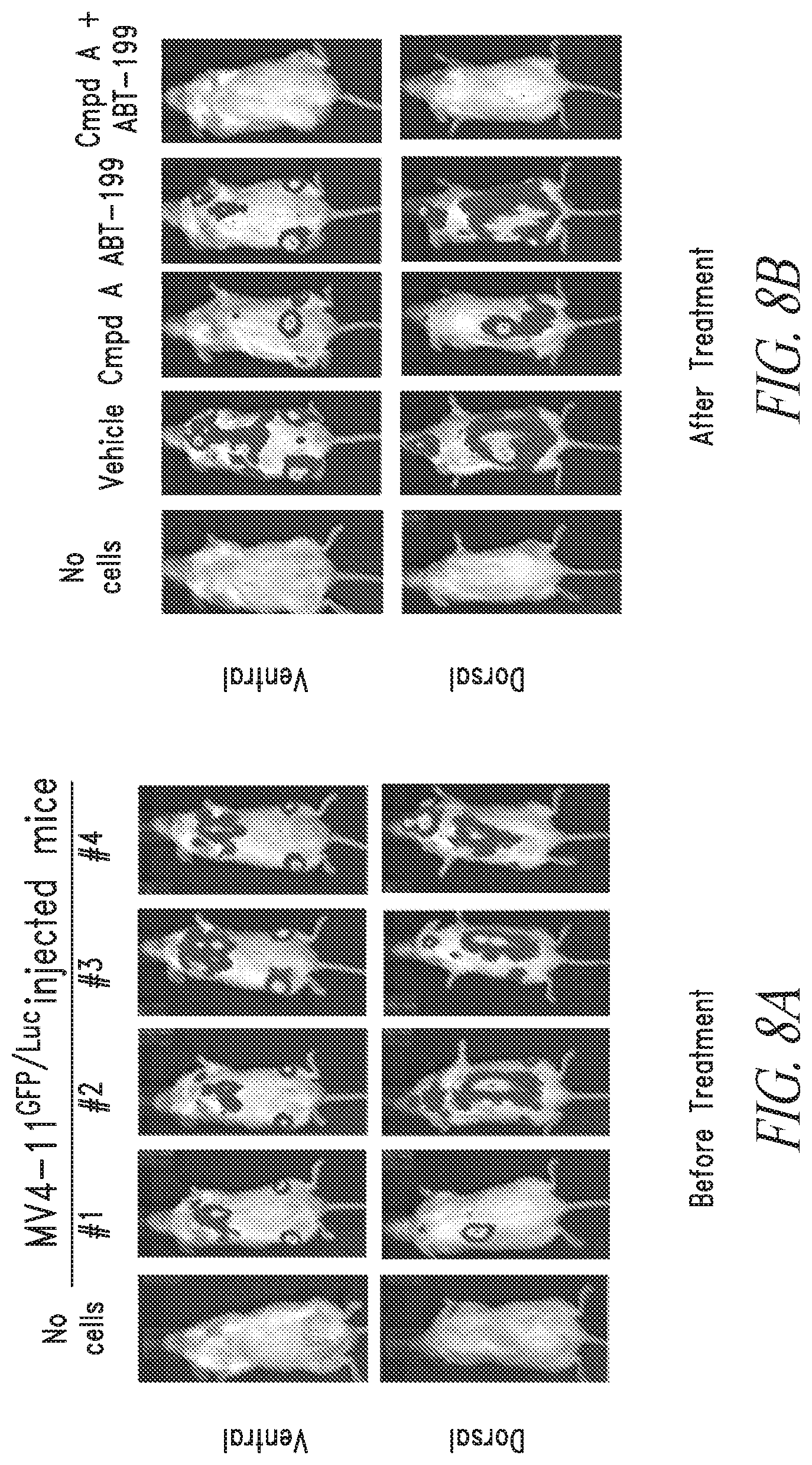 Patent US12097194 Figure 7 – Combination therapy for treating blood cancer