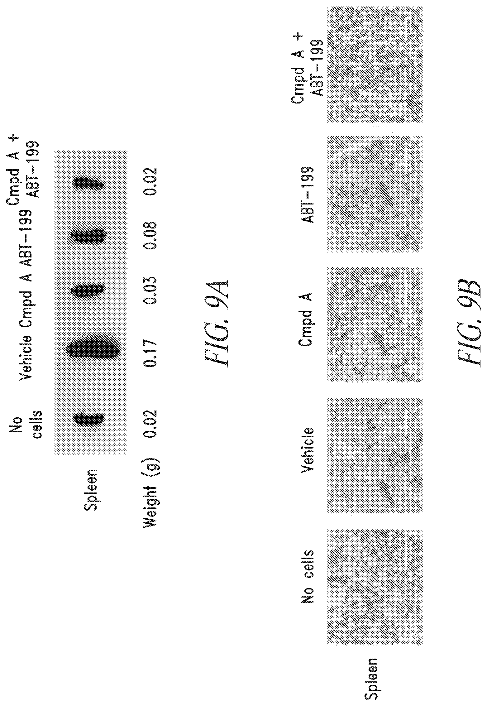 Patent US12097194 Figure 8 – Combination therapy for treating blood cancer