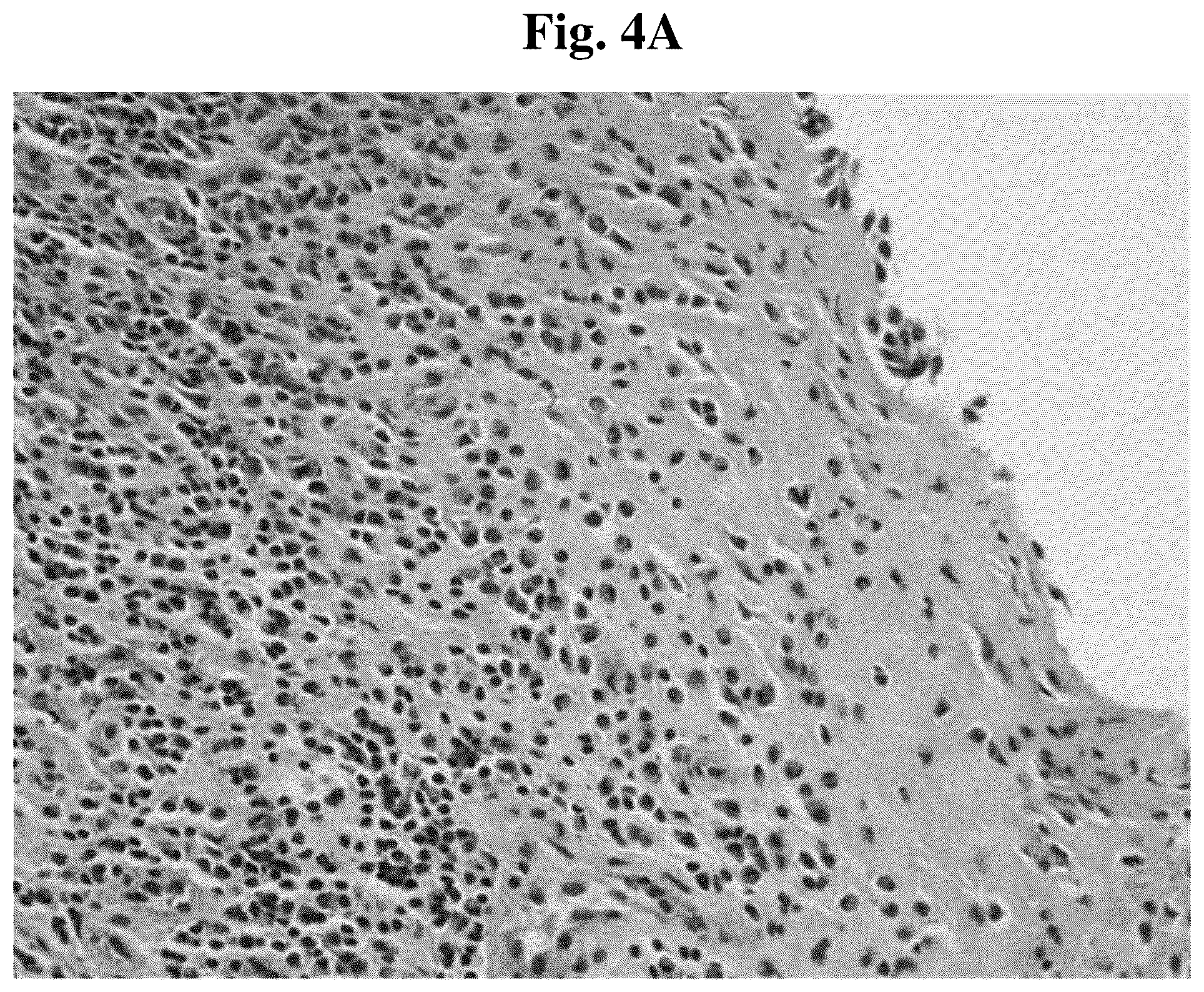 Patent US12097208 Figure 8 – Method for treating nasal, sinonasal, and nasopharyngeal tissue infection and/or inflammation