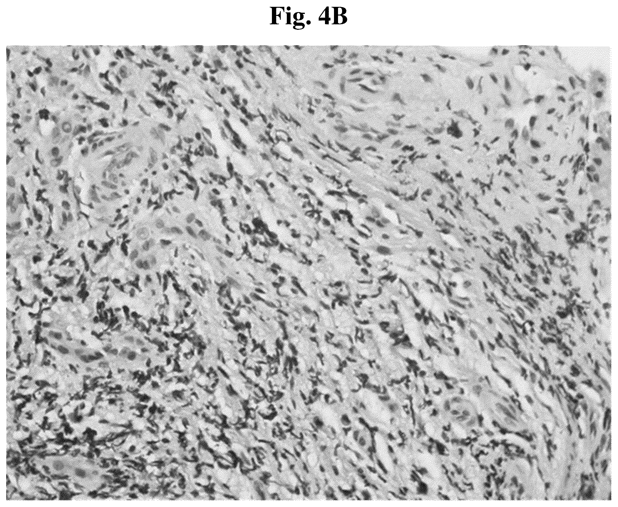 Patent US12097208 Figure 9 – Method for treating nasal, sinonasal, and nasopharyngeal tissue infection and/or inflammation