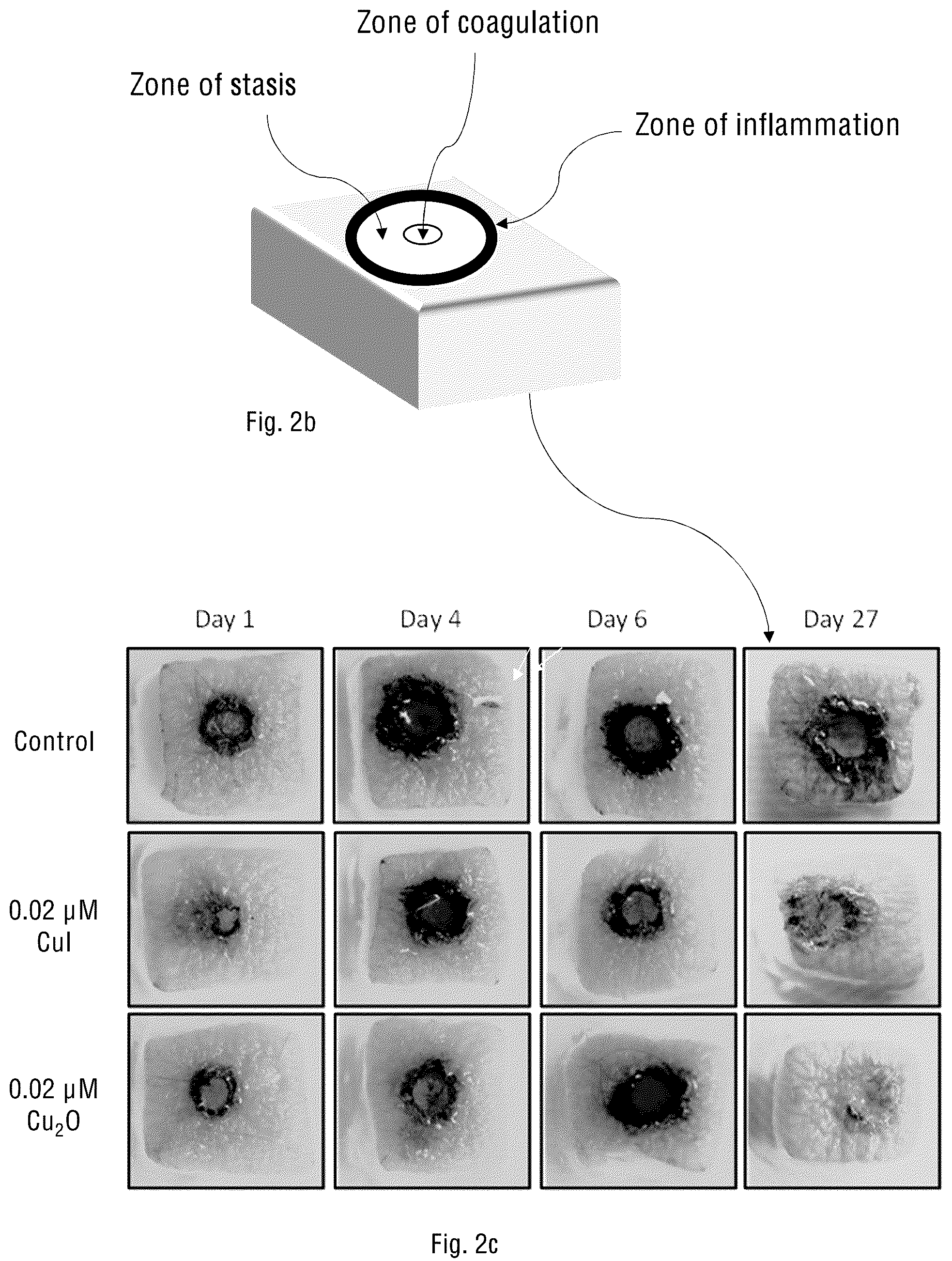 Patent US12097216 Figure 3 – Method for prevention and reduction of skin stasis with compositions and materials comprising copper compounds