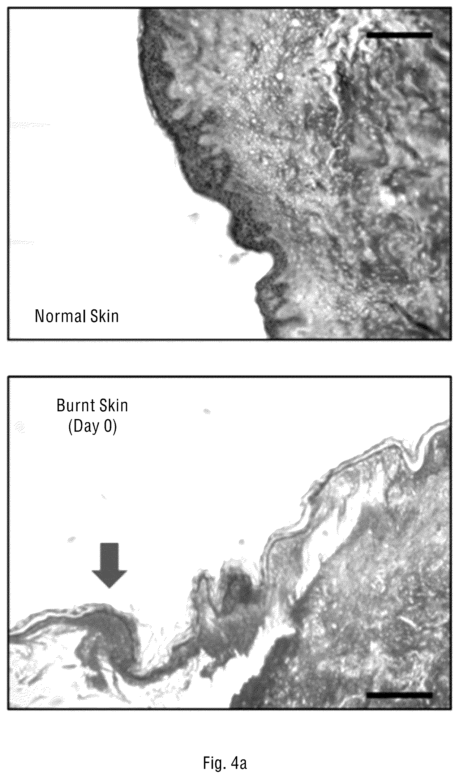 Patent US12097216 Figure 7 – Method for prevention and reduction of skin stasis with compositions and materials comprising copper compounds