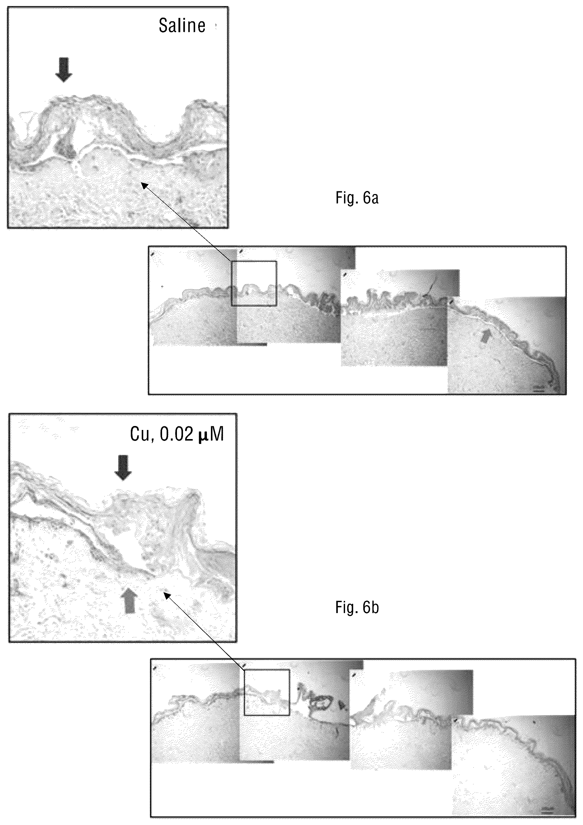 Patent US12097216 Figure 11 – Method for prevention and reduction of skin stasis with compositions and materials comprising copper compounds