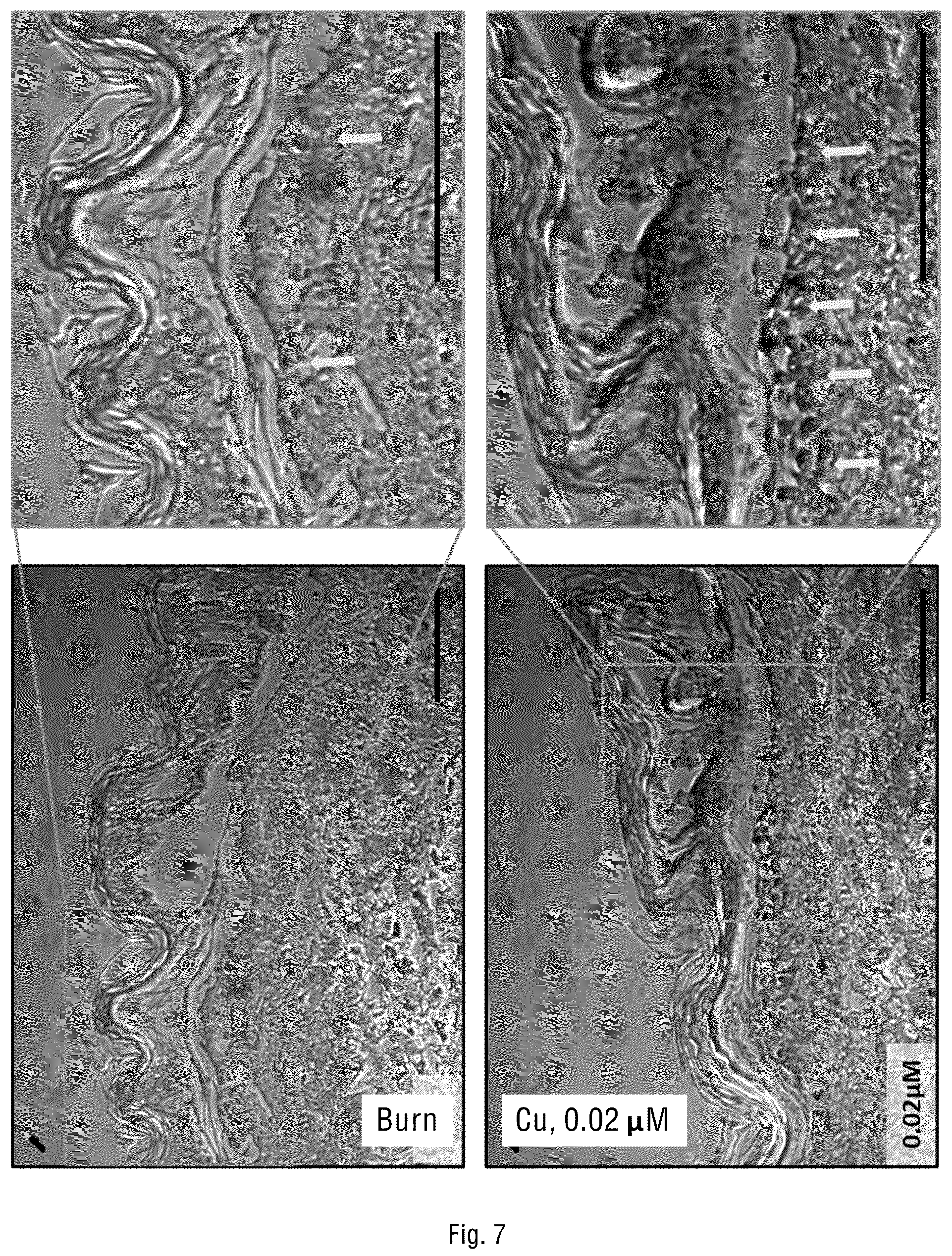 Patent US12097216 Figure 13 – Method for prevention and reduction of skin stasis with compositions and materials comprising copper compounds