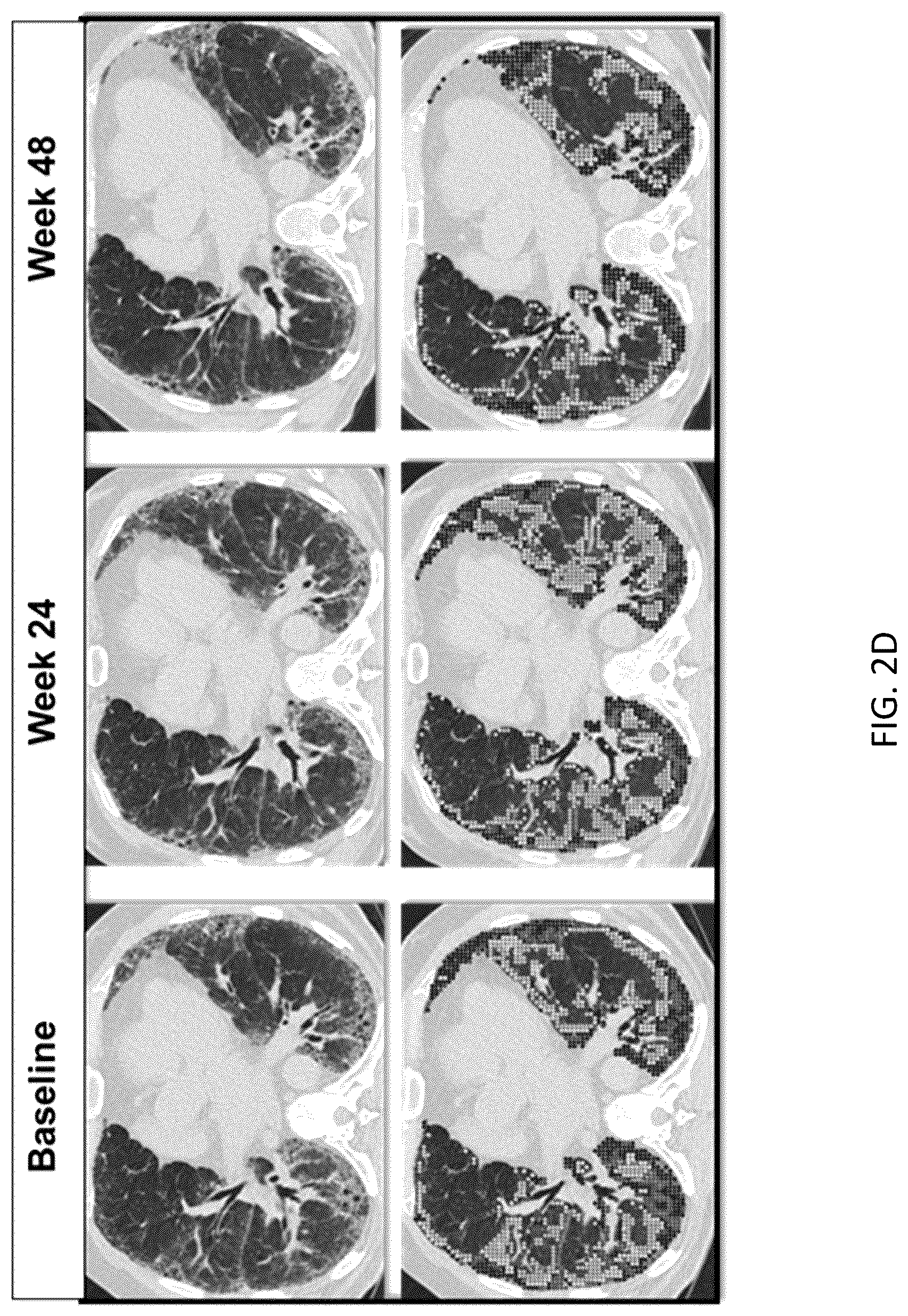 Patent US12097222 Figure 5 – Methods for attenuating viral infection and for treating lung injury
