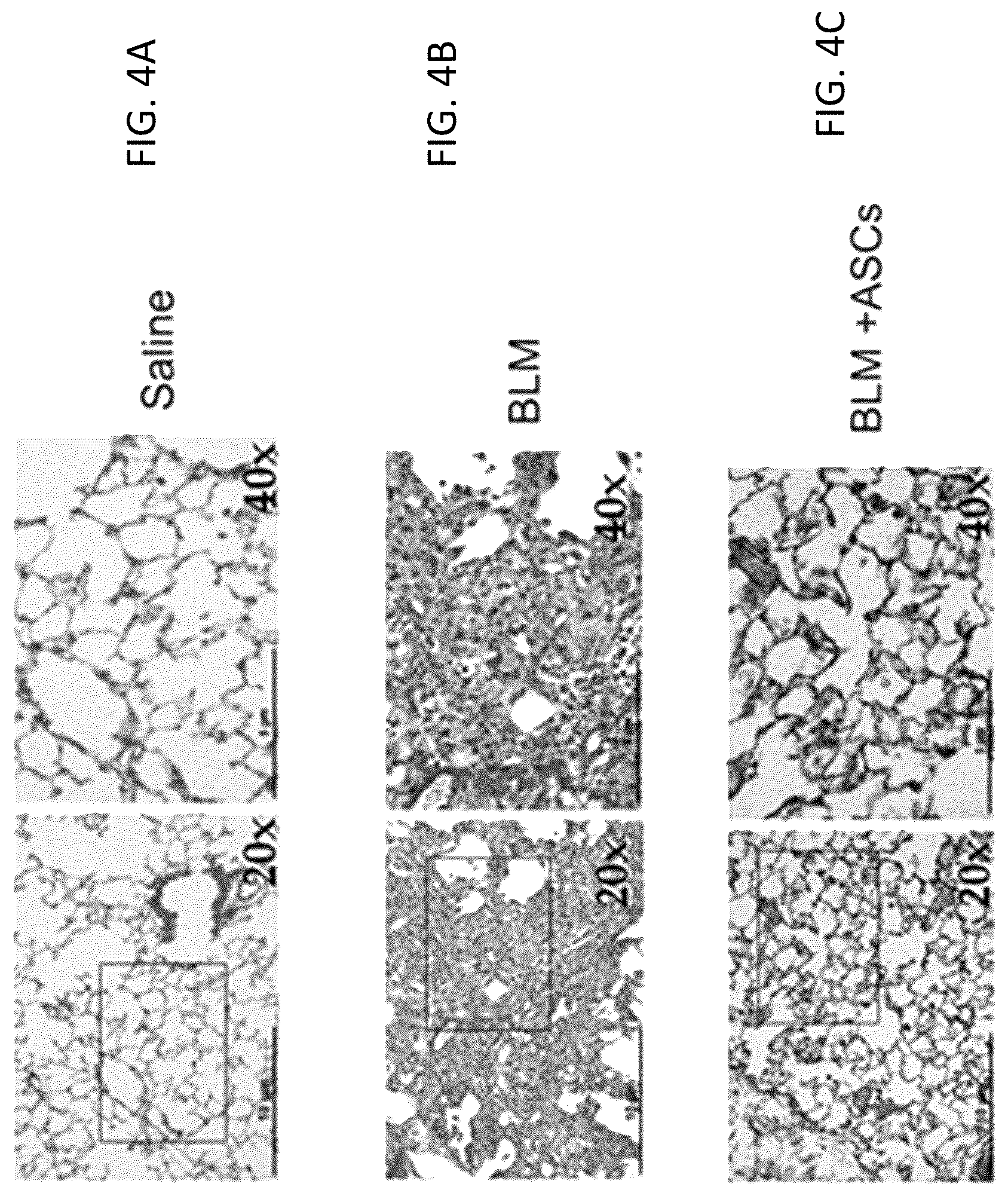 Patent US12097222 Figure 8 – Methods for attenuating viral infection and for treating lung injury