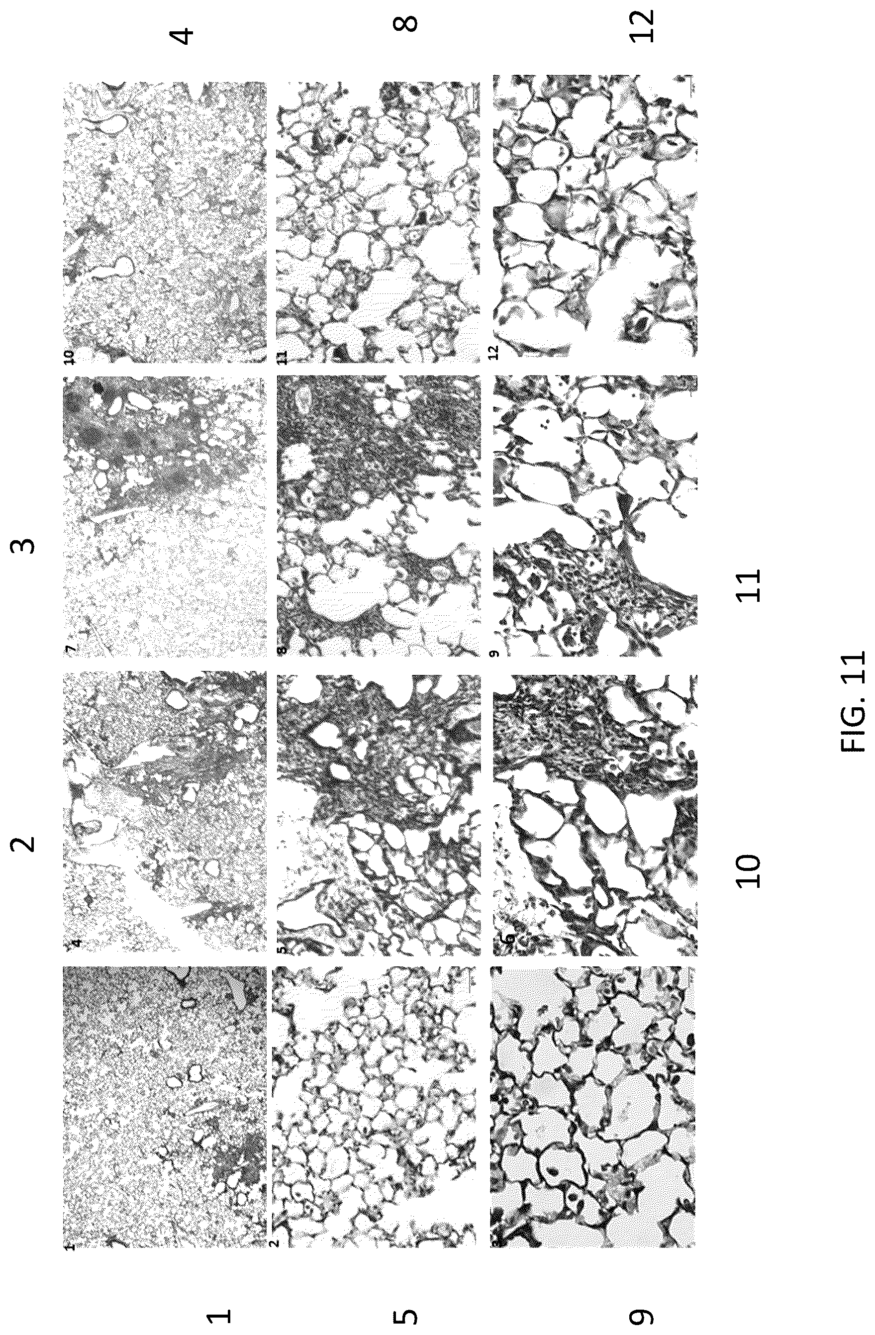Patent US12097222 Figure 19 – Methods for attenuating viral infection and for treating lung injury