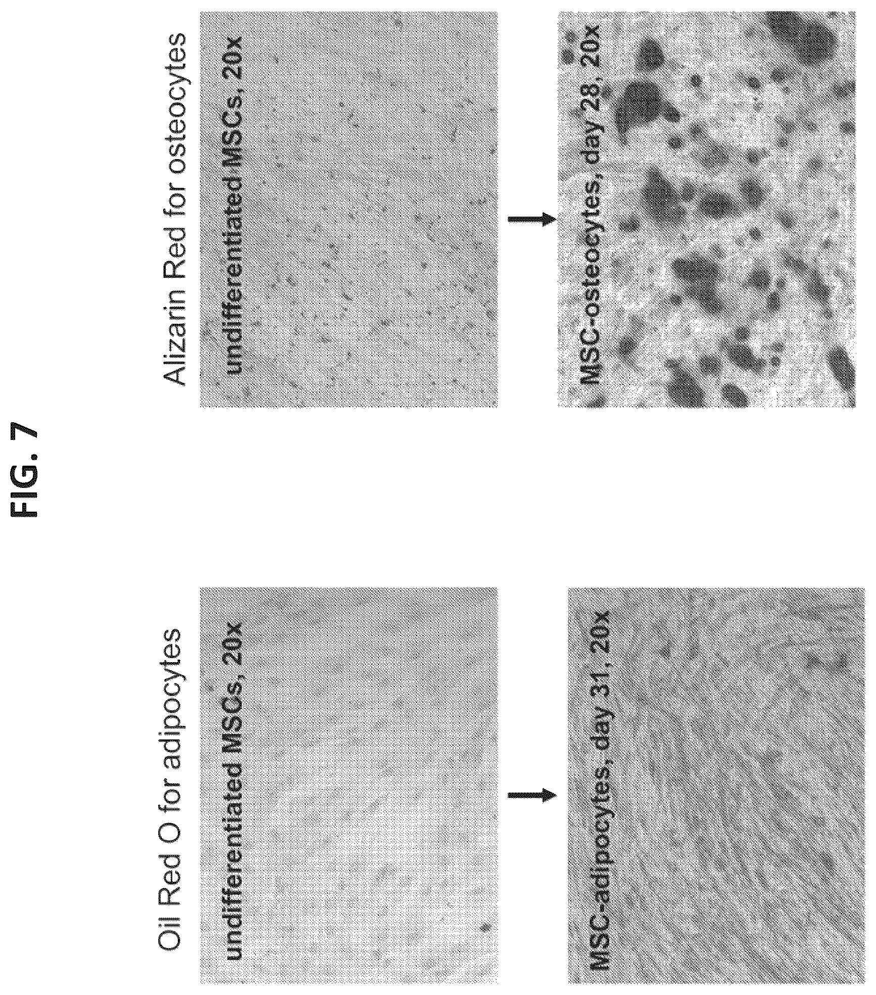 Patent US12097223 Figure 7 – Mesenchymal stromal cells and uses related thereto