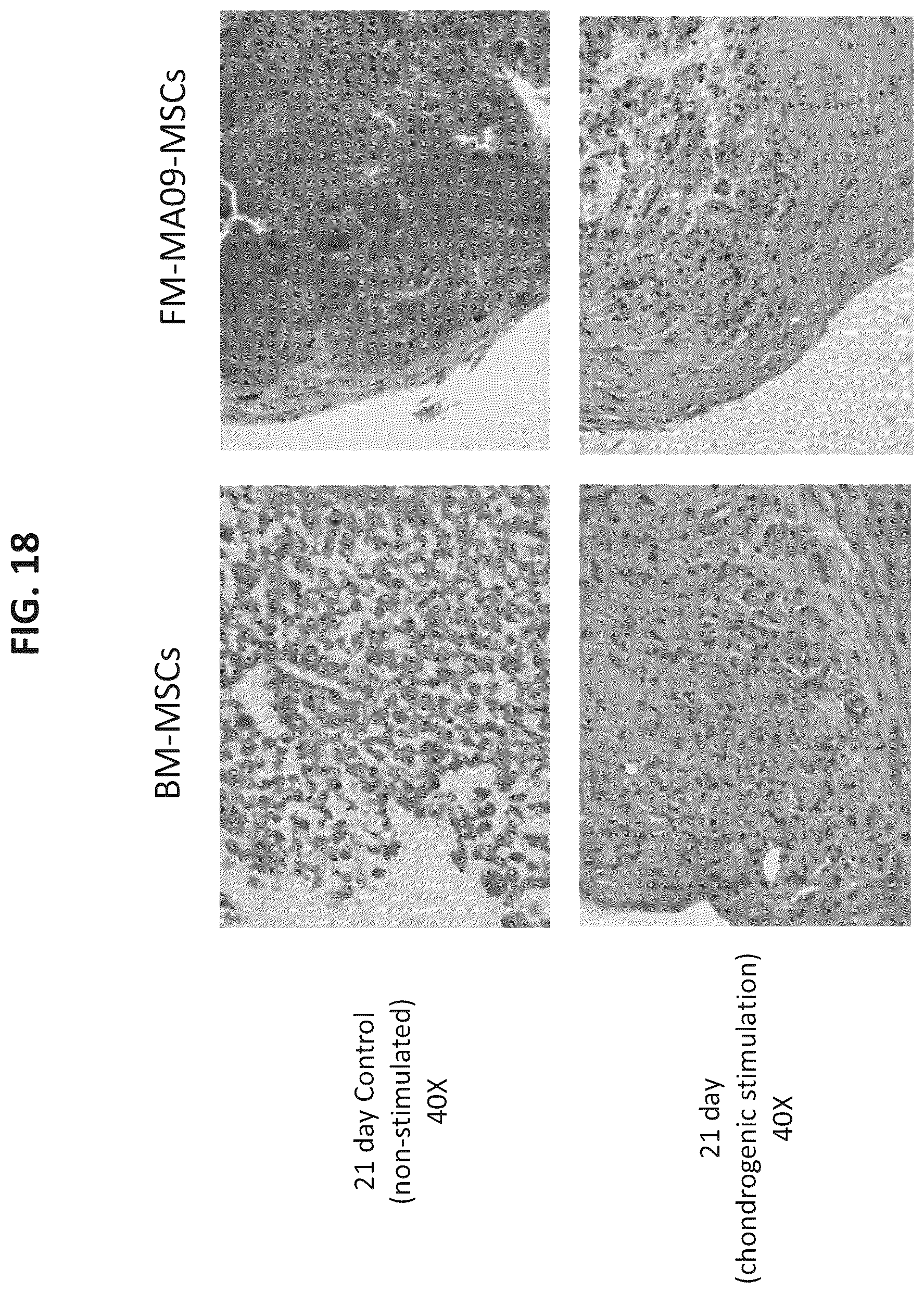 Patent US12097223 Figure 19 – Mesenchymal stromal cells and uses related thereto