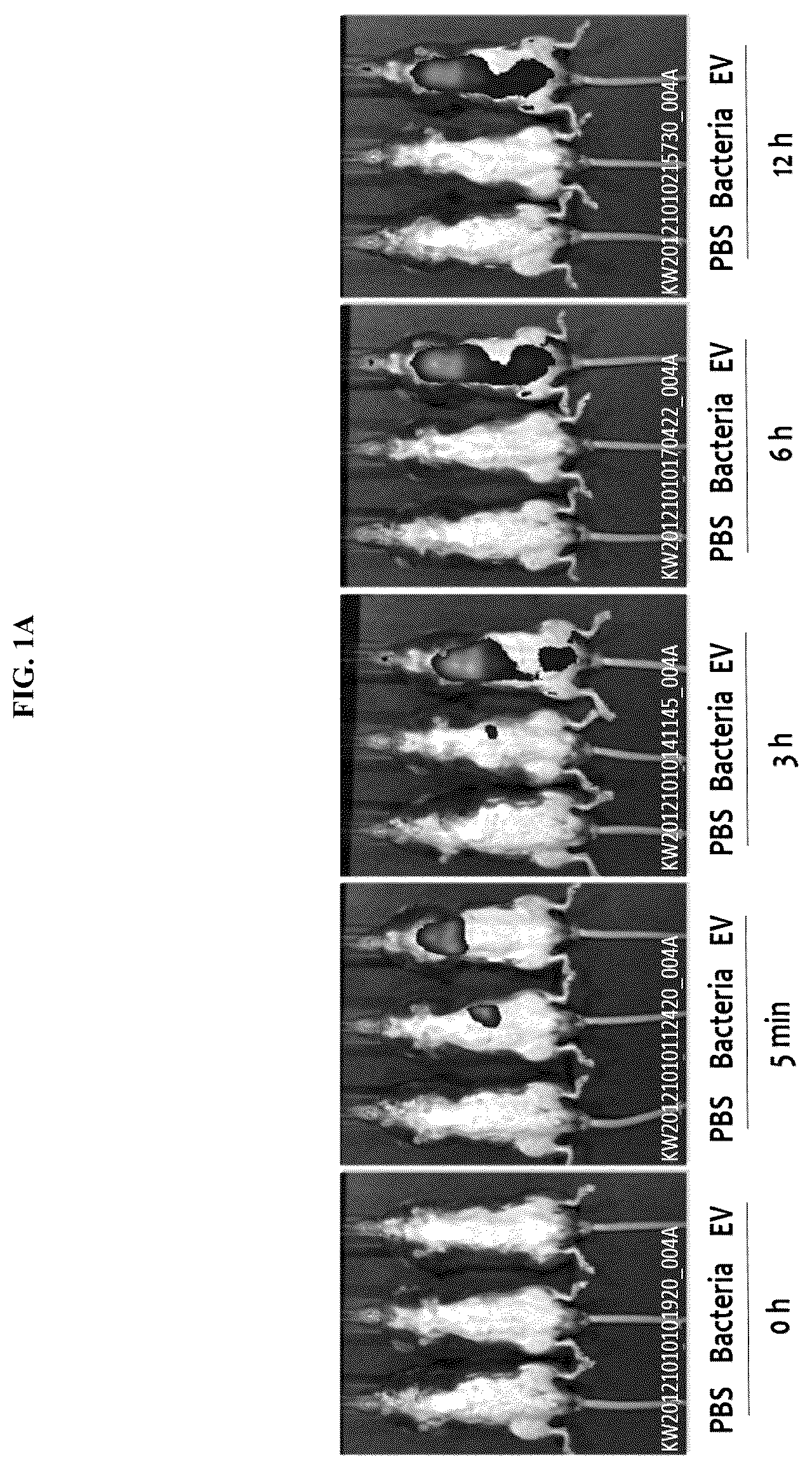 Patent US12097227 Figure 1 – Nanovesicles derived from bacteria of Lactococcus genus and use thereof