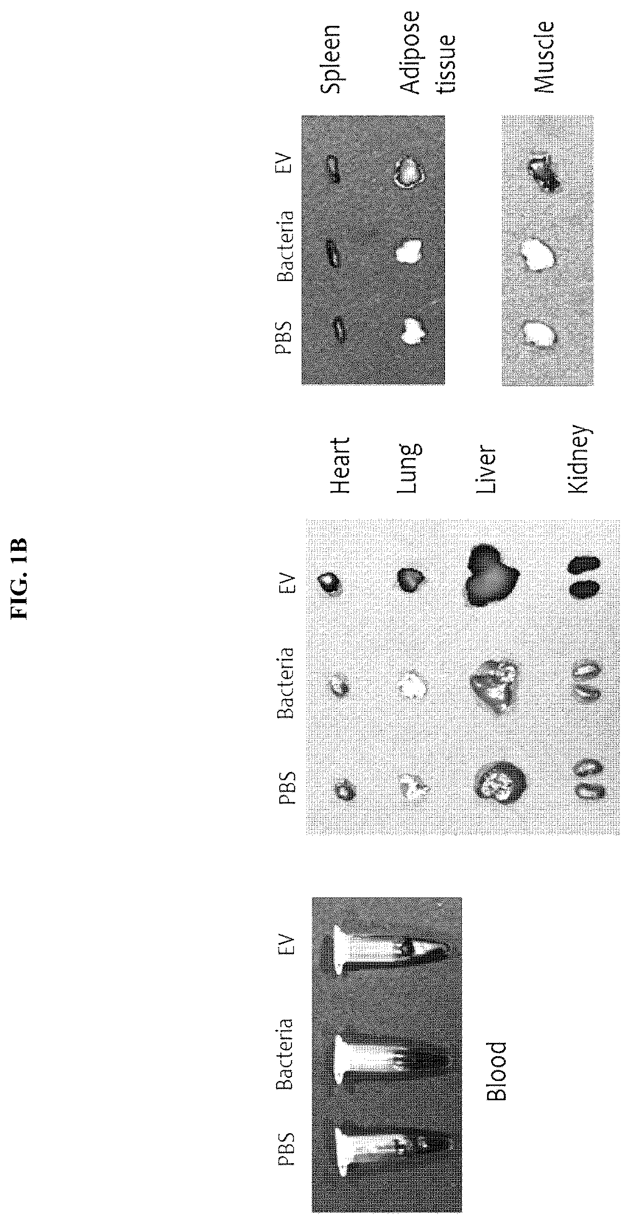 Patent US12097227 Figure 2 – Nanovesicles derived from bacteria of Lactococcus genus and use thereof