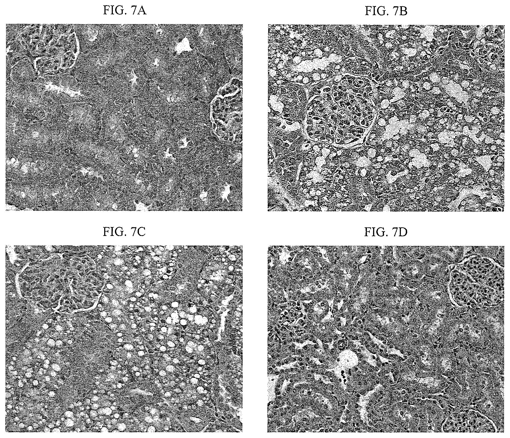 Patent US12097242 Figure 3 – Treatment of fibrosis, cardiovascular disease and heart failure with modified relaxin polypeptides