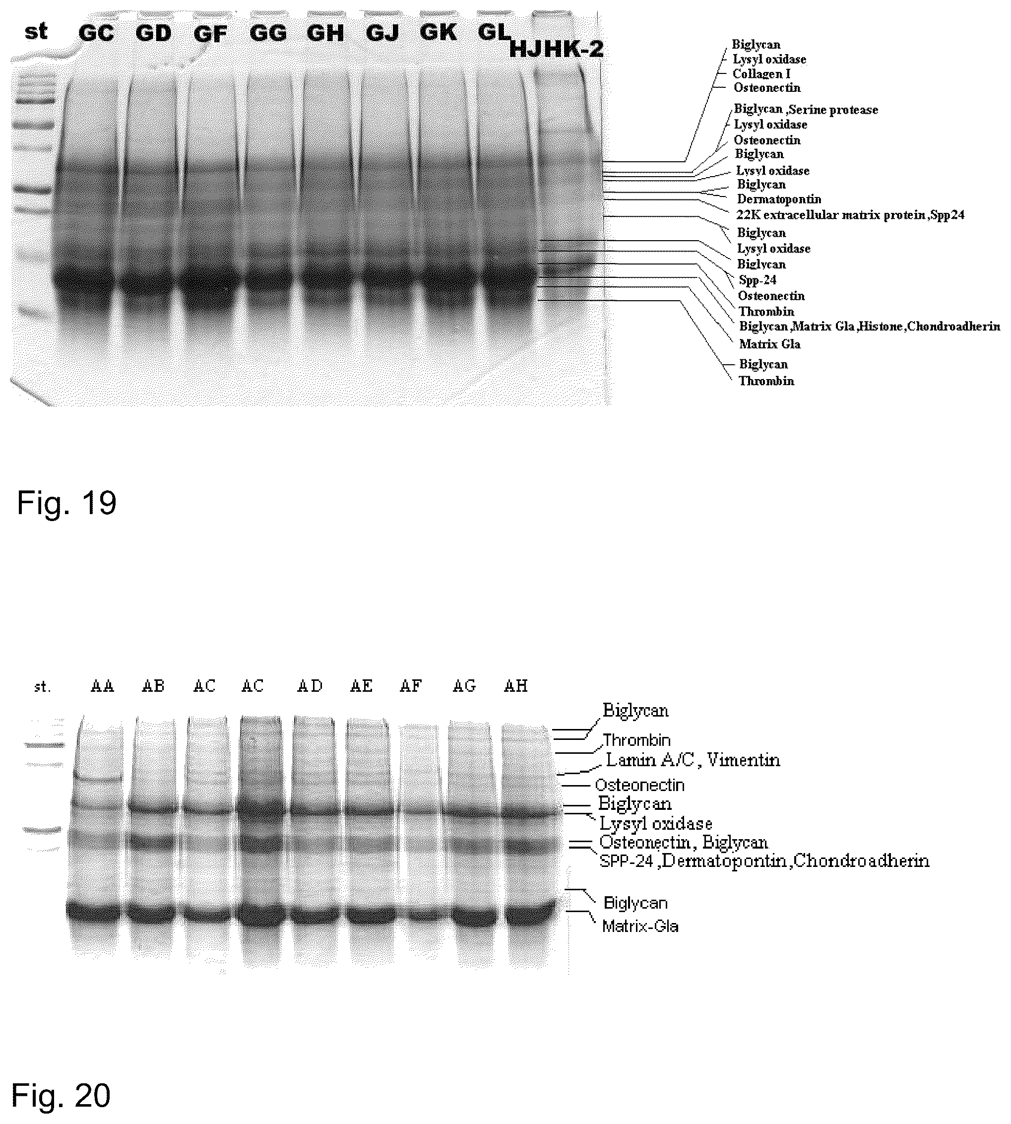 Patent US12097243 Figure 14 – Method for preparing a bone protein preparation and a bone protein preparation
