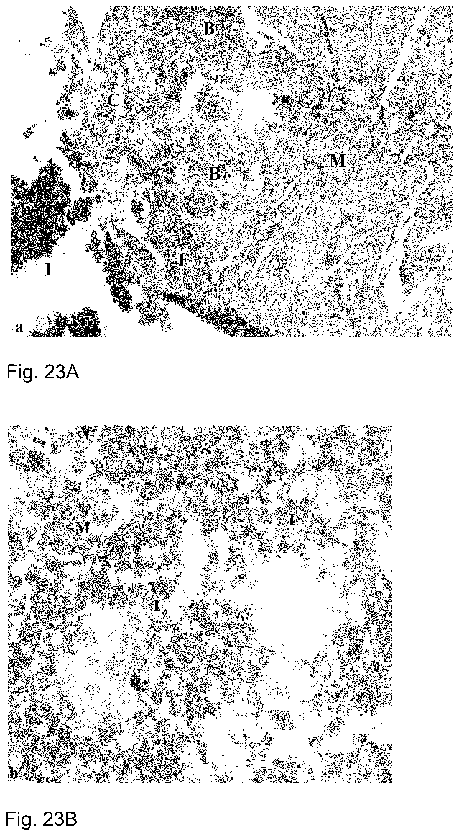 Patent US12097243 Figure 16 – Method for preparing a bone protein preparation and a bone protein preparation