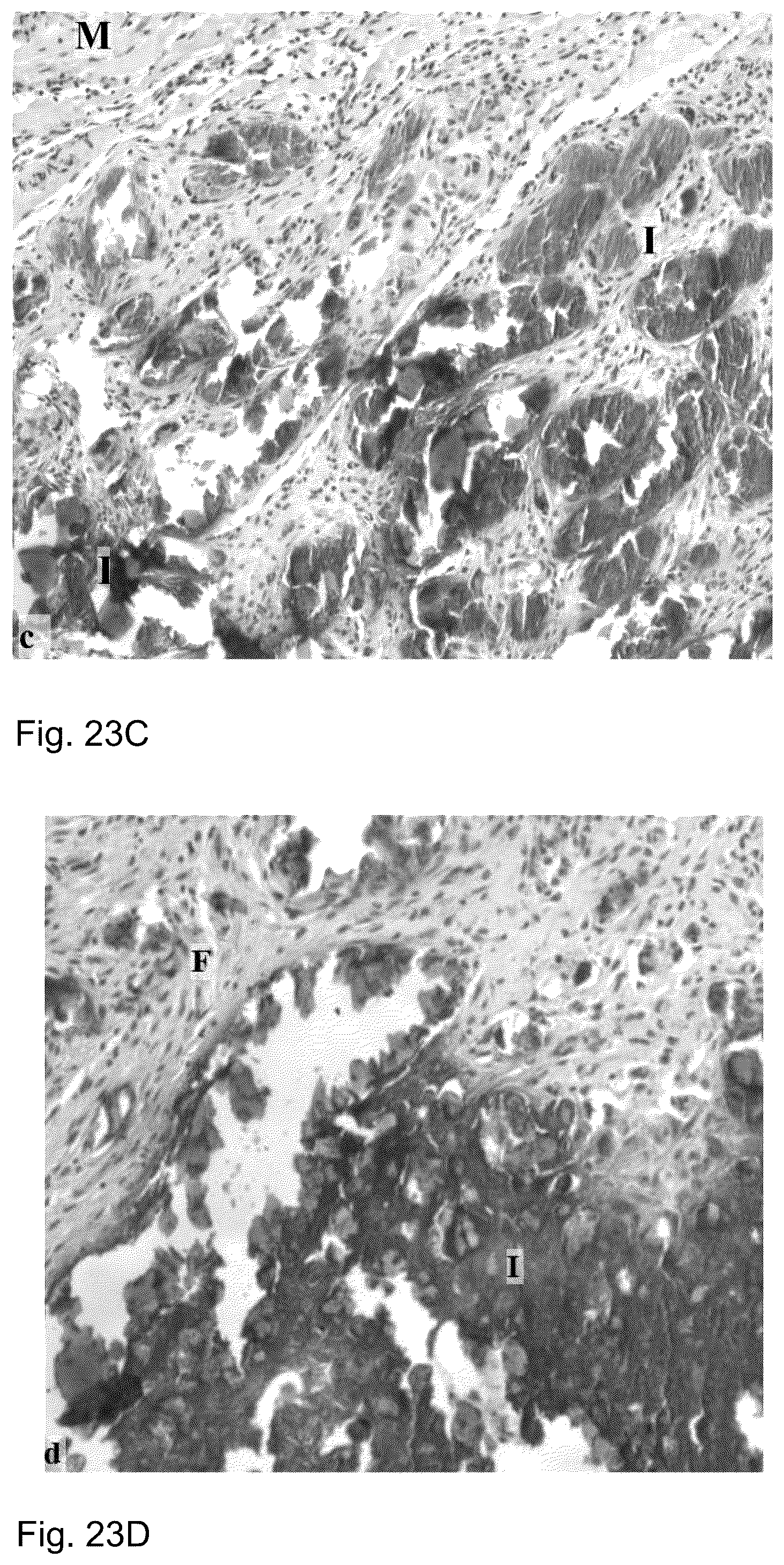 Patent US12097243 Figure 17 – Method for preparing a bone protein preparation and a bone protein preparation