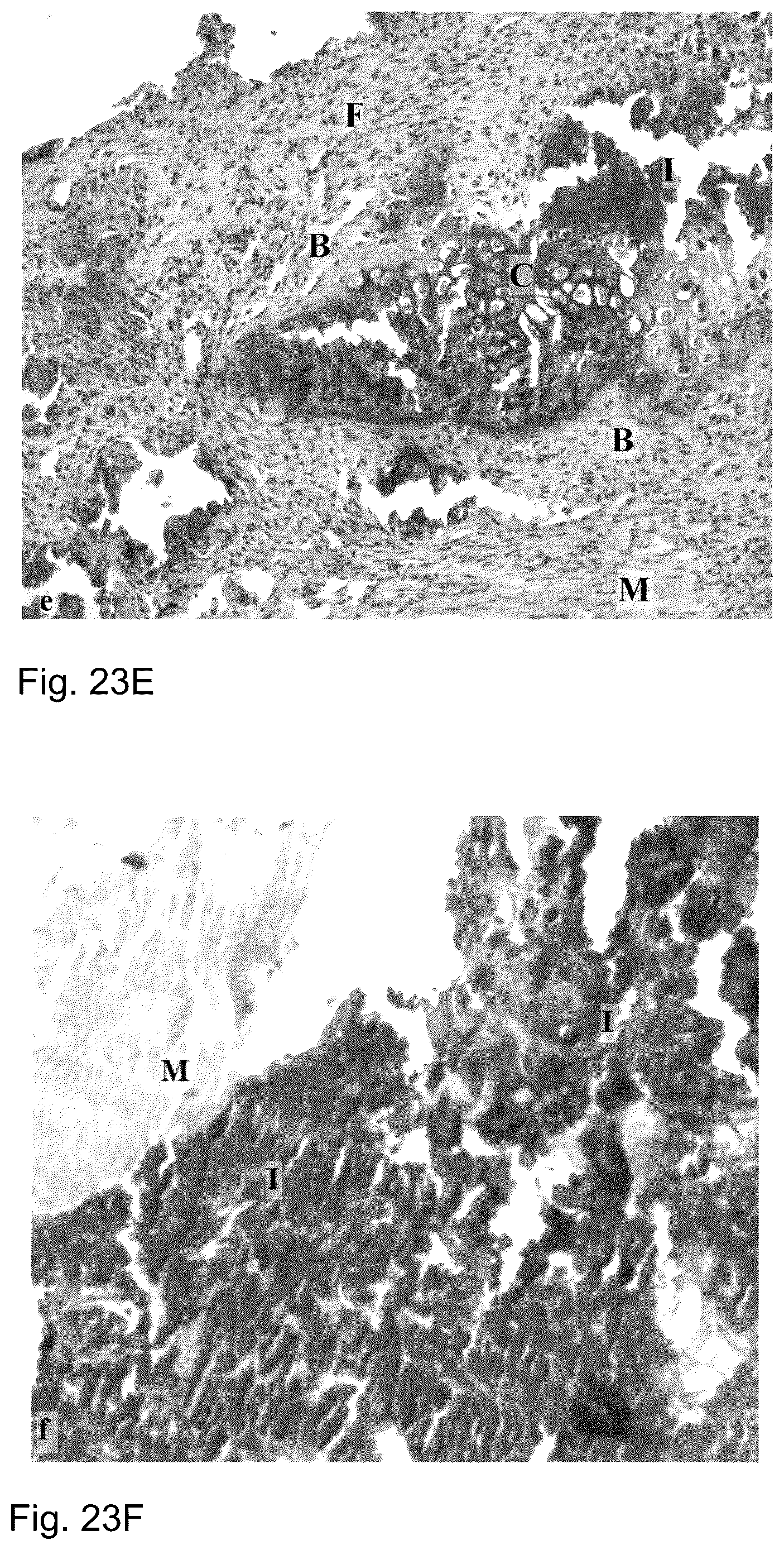 Patent US12097243 Figure 18 – Method for preparing a bone protein preparation and a bone protein preparation