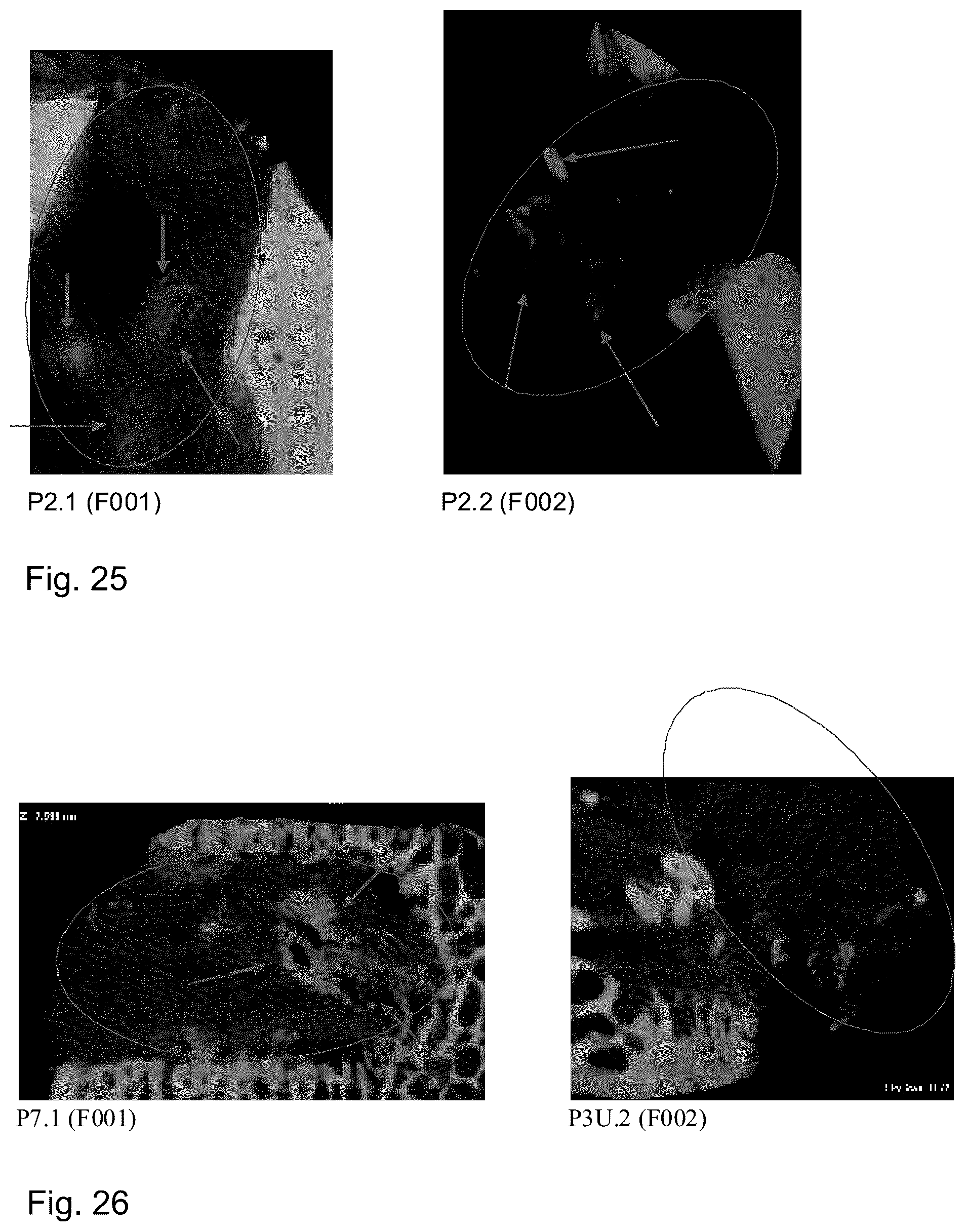 Patent US12097243 Figure 20 – Method for preparing a bone protein preparation and a bone protein preparation