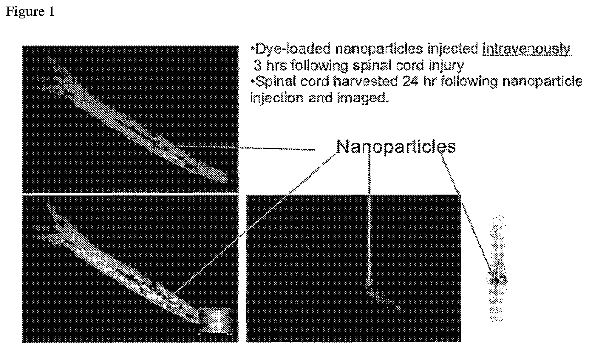 Patent US12097246 Figure 1 – Methods of treating spinal cord injury
