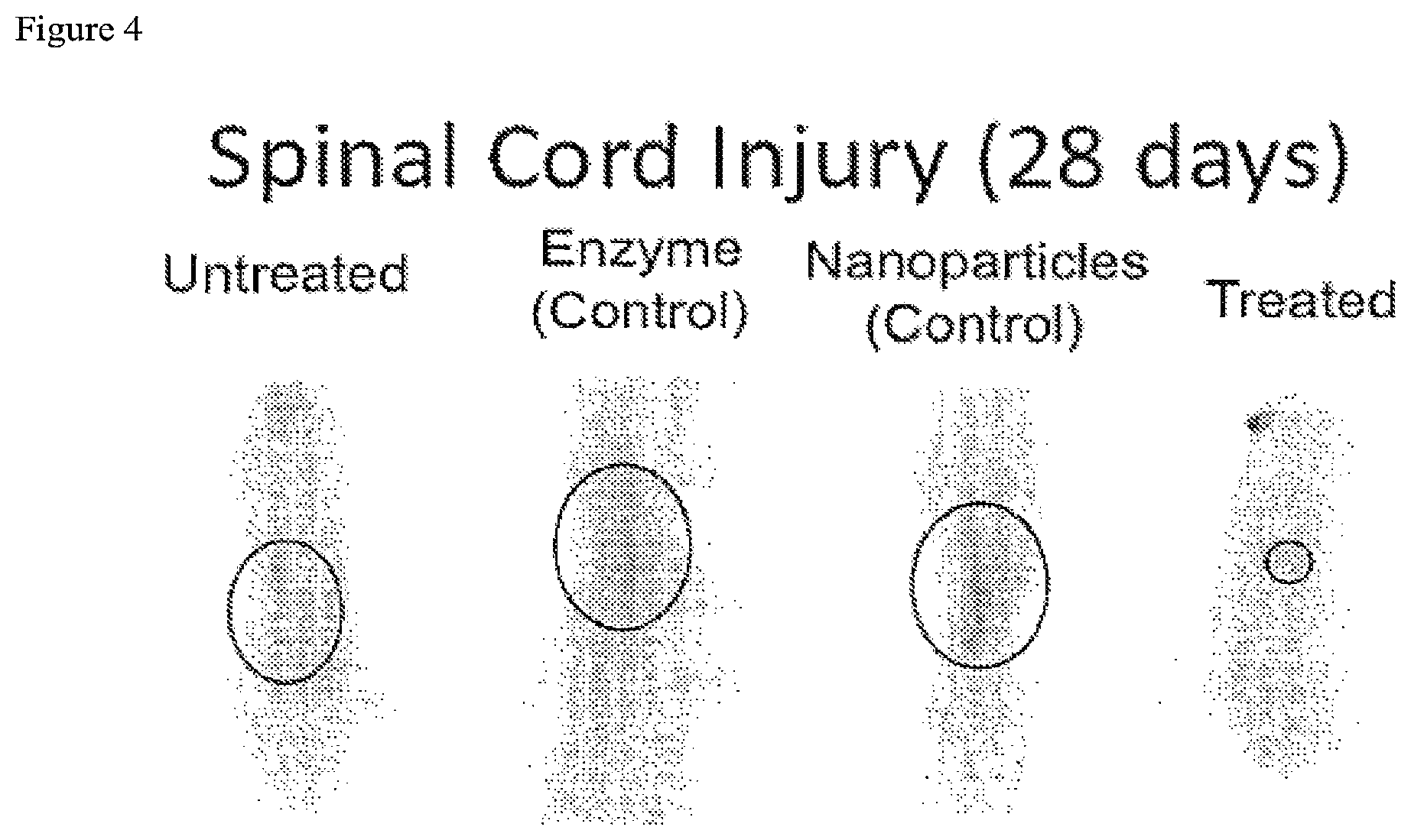 Patent US12097246 Figure 4 – Methods of treating spinal cord injury
