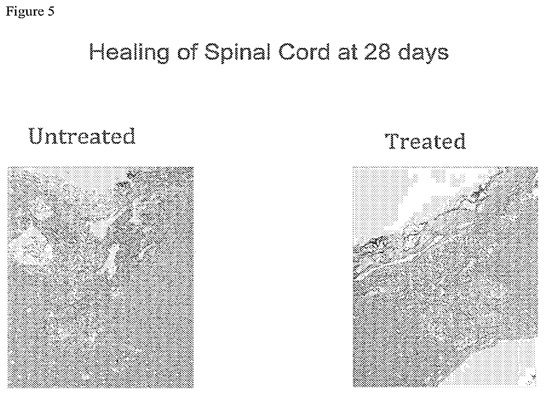 Patent US12097246 Figure 5 – Methods of treating spinal cord injury