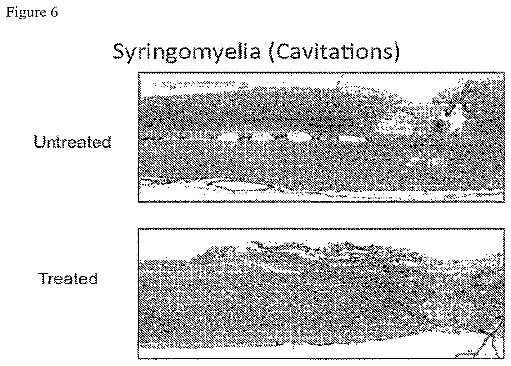Patent US12097246 Figure 6 – Methods of treating spinal cord injury