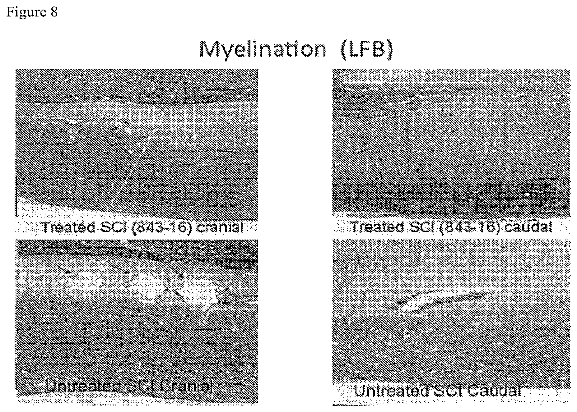 Patent US12097246 Figure 8 – Methods of treating spinal cord injury