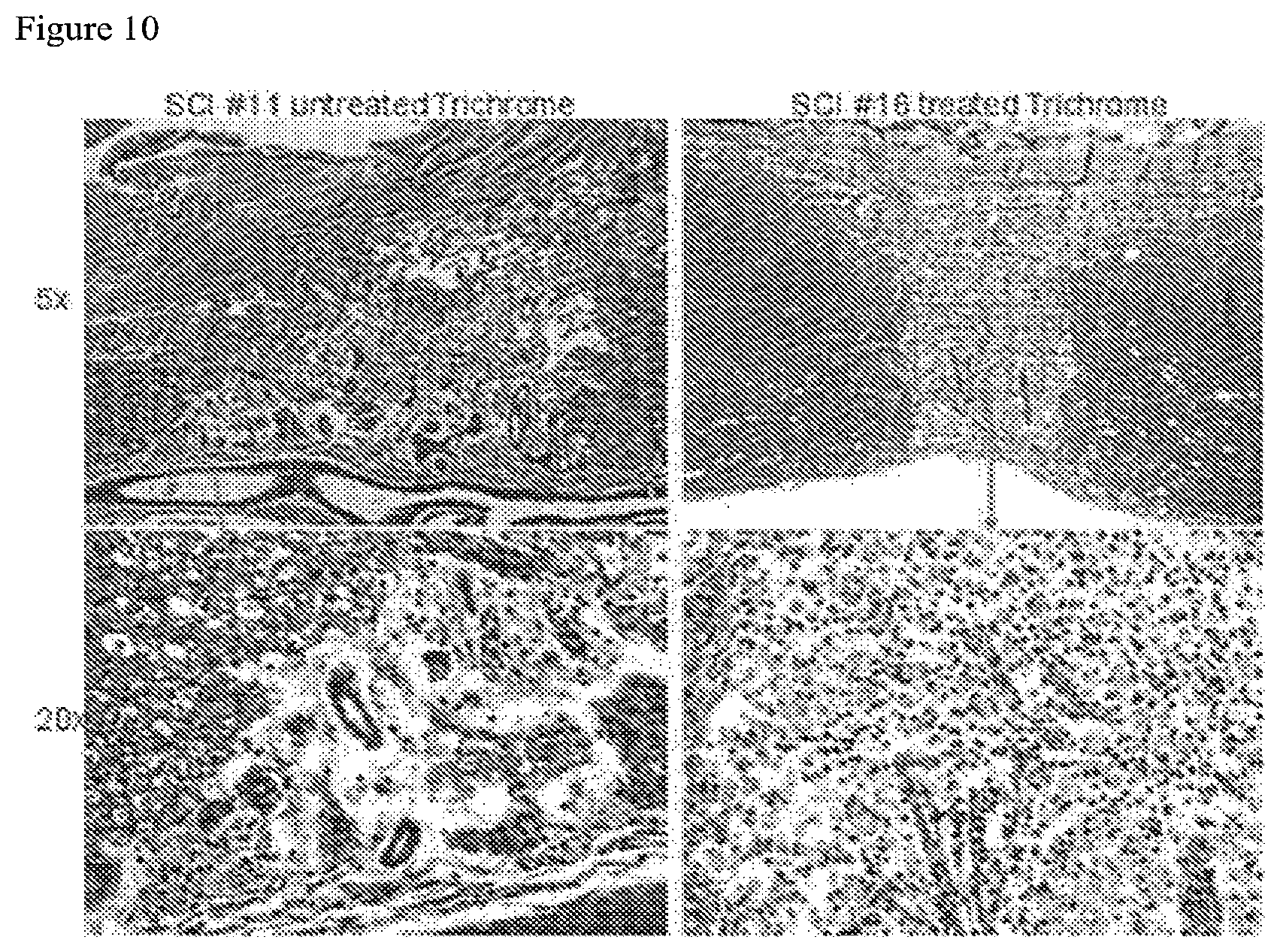 Patent US12097246 Figure 10 – Methods of treating spinal cord injury