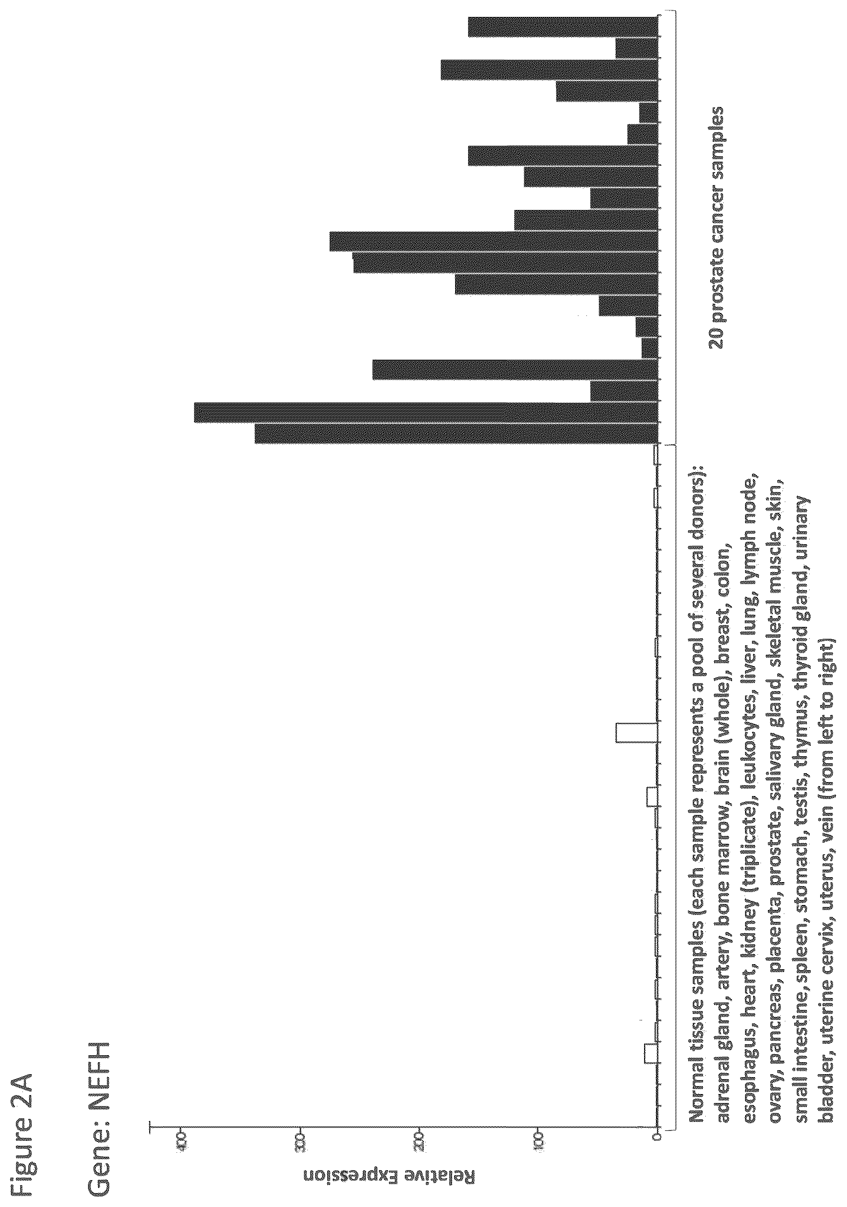 Patent US12097249 Figure 20 – Peptides and combination of peptides for use in immunotherapy against prostate cancer and other cancers