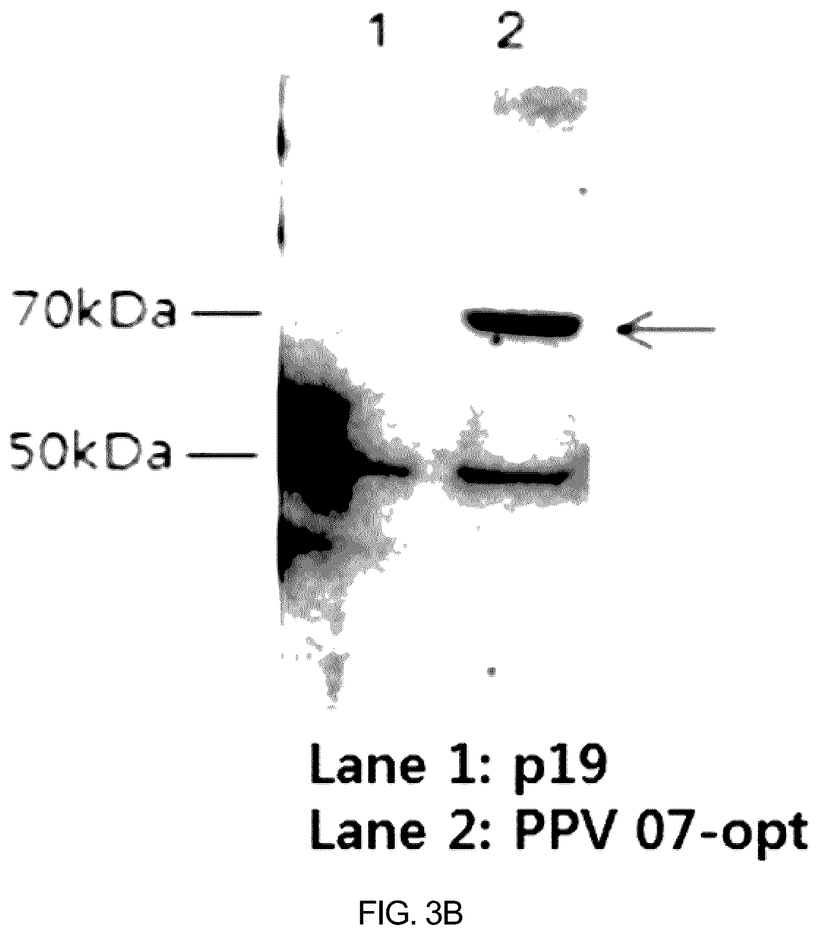 Patent US12097255 Figure 3 – Recombinant porcine parvovirus antigenic protein and use thereof