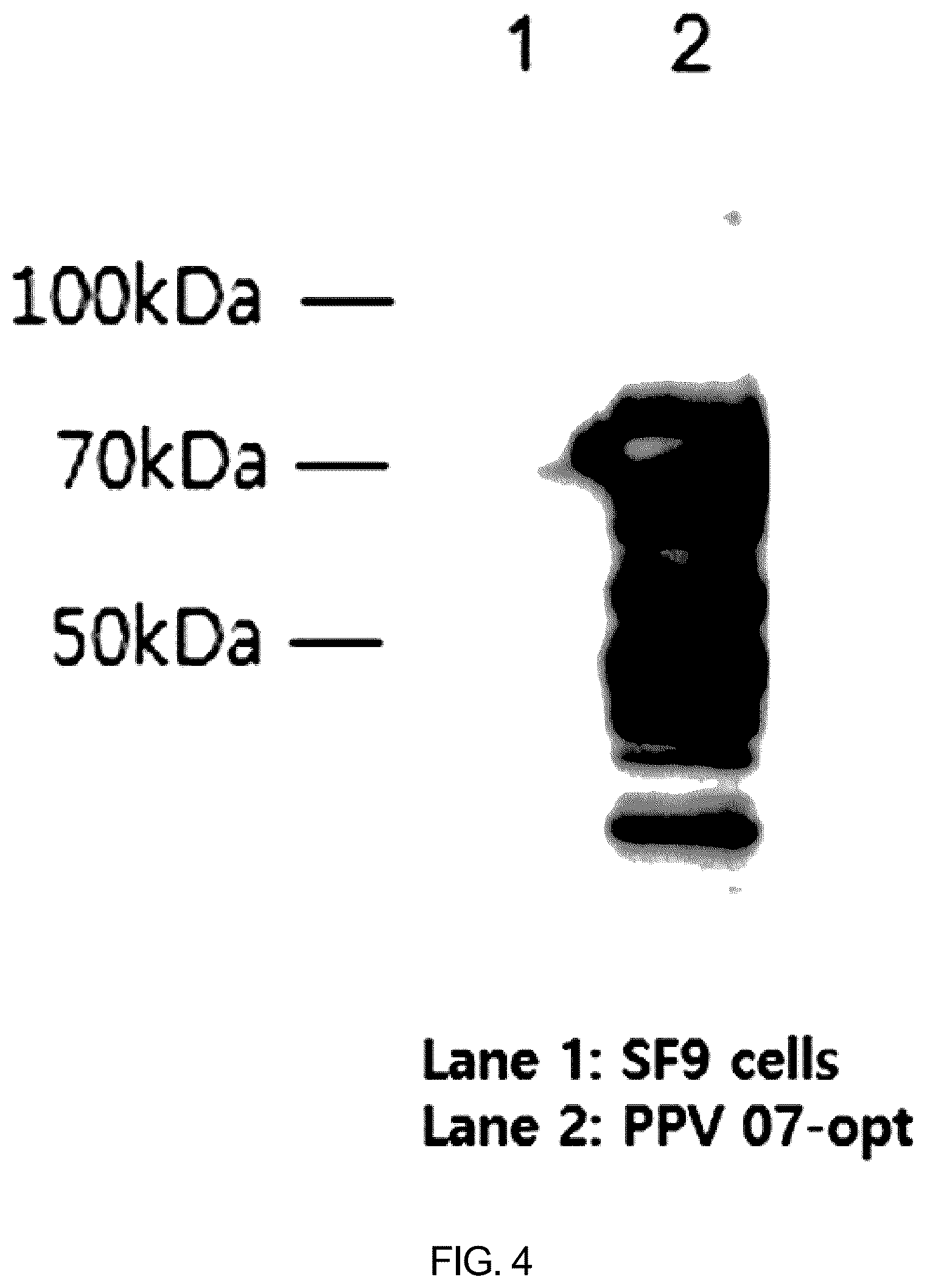 Patent US12097255 Figure 5 – Recombinant porcine parvovirus antigenic protein and use thereof
