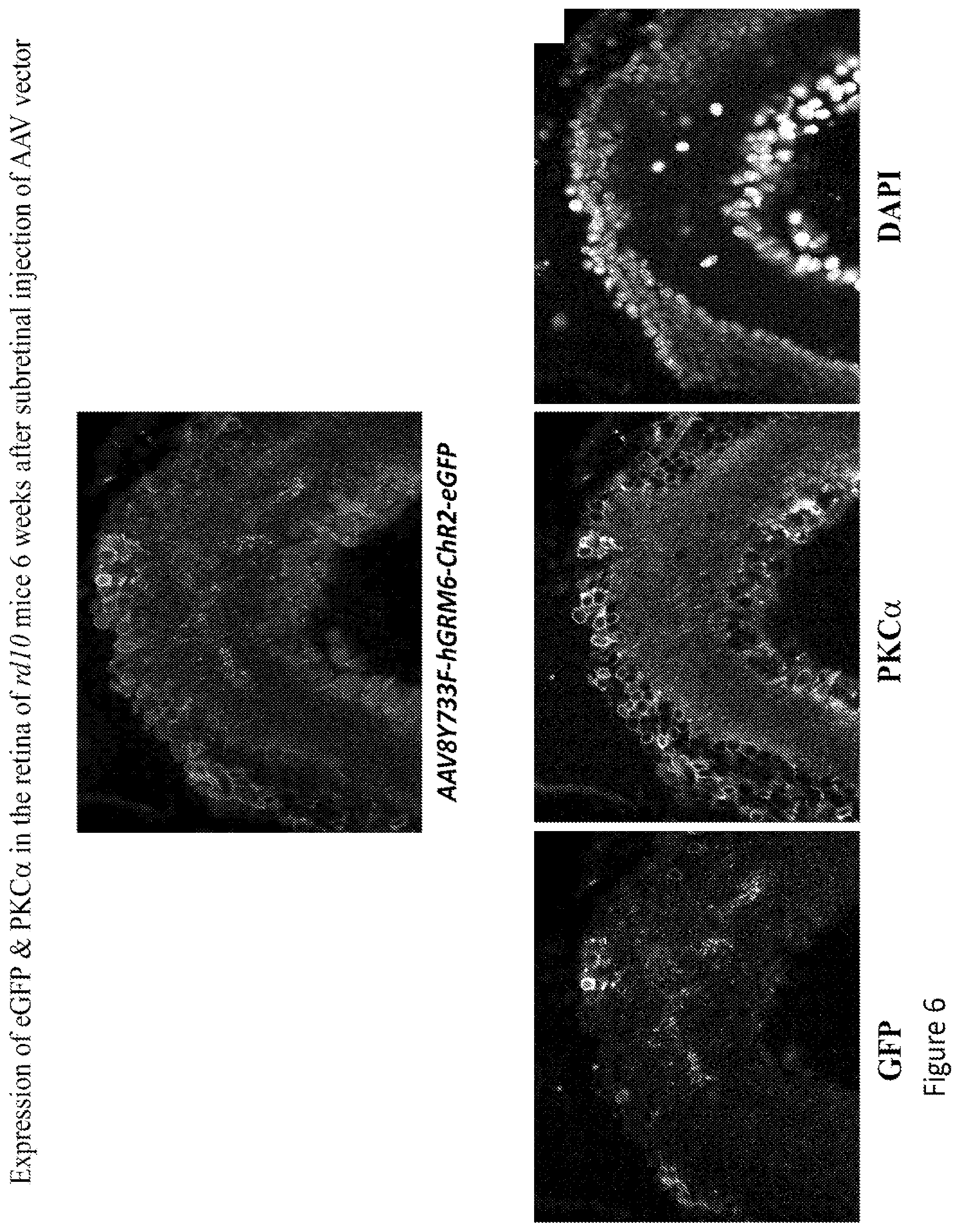 Patent US12097268 Figure 7 – Modulation of neural pathways