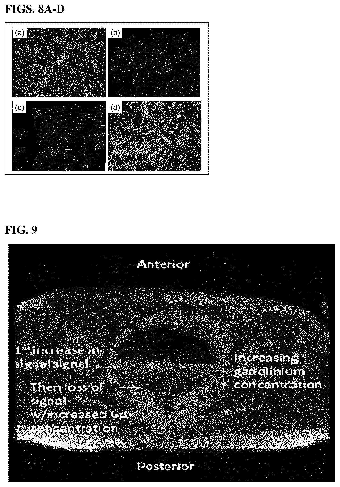 Patent US12097269 Figure 5 – Dual mode gadolinium nanoparticle contrast agents