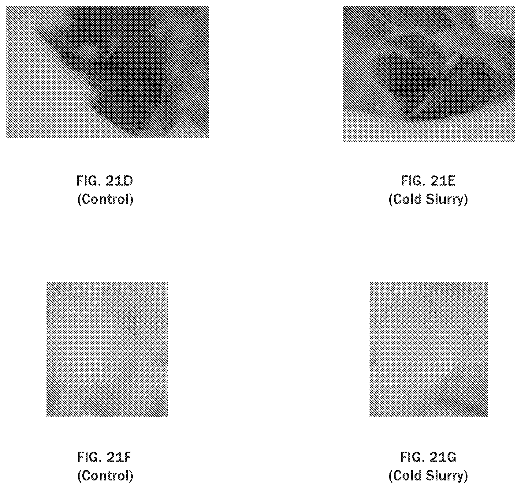 Patent US12097282 Figure 20 – Injectable slurries and methods of manufacturing the same