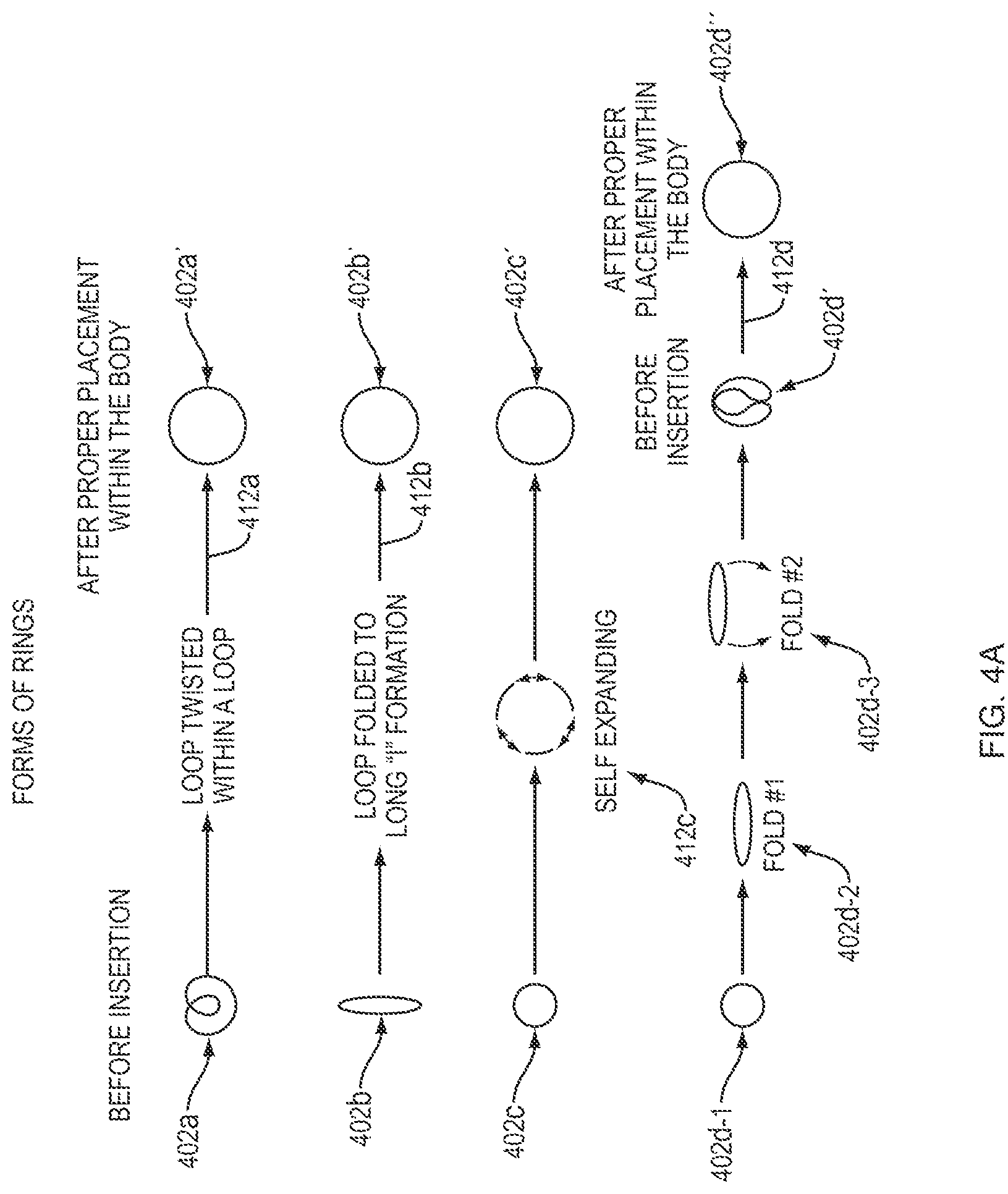 Patent US12097288 Figure 4 – Hydrocortisone acetate suppository formulation for treatment of disease