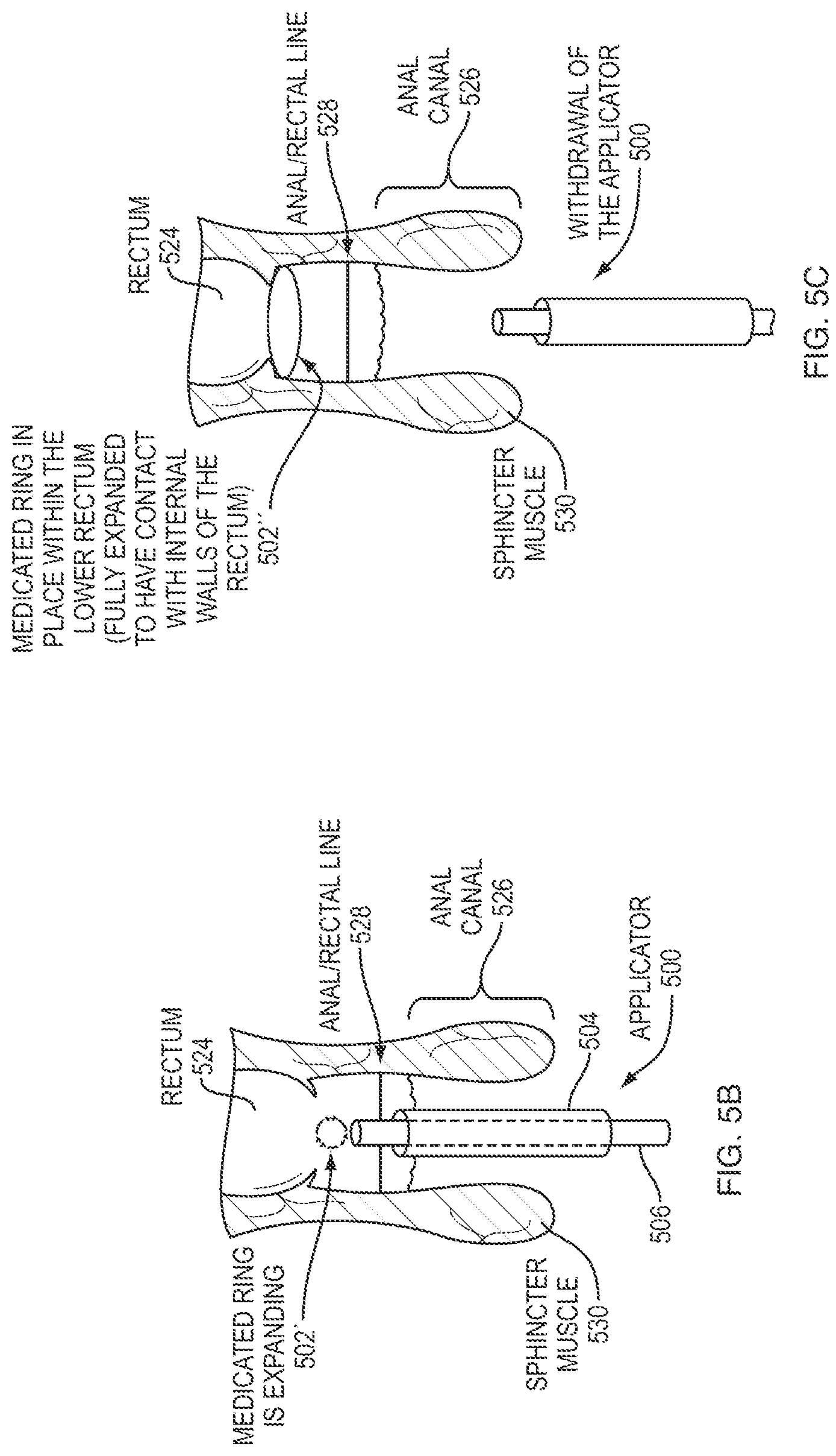 Patent US12097288 Figure 7 – Hydrocortisone acetate suppository formulation for treatment of disease