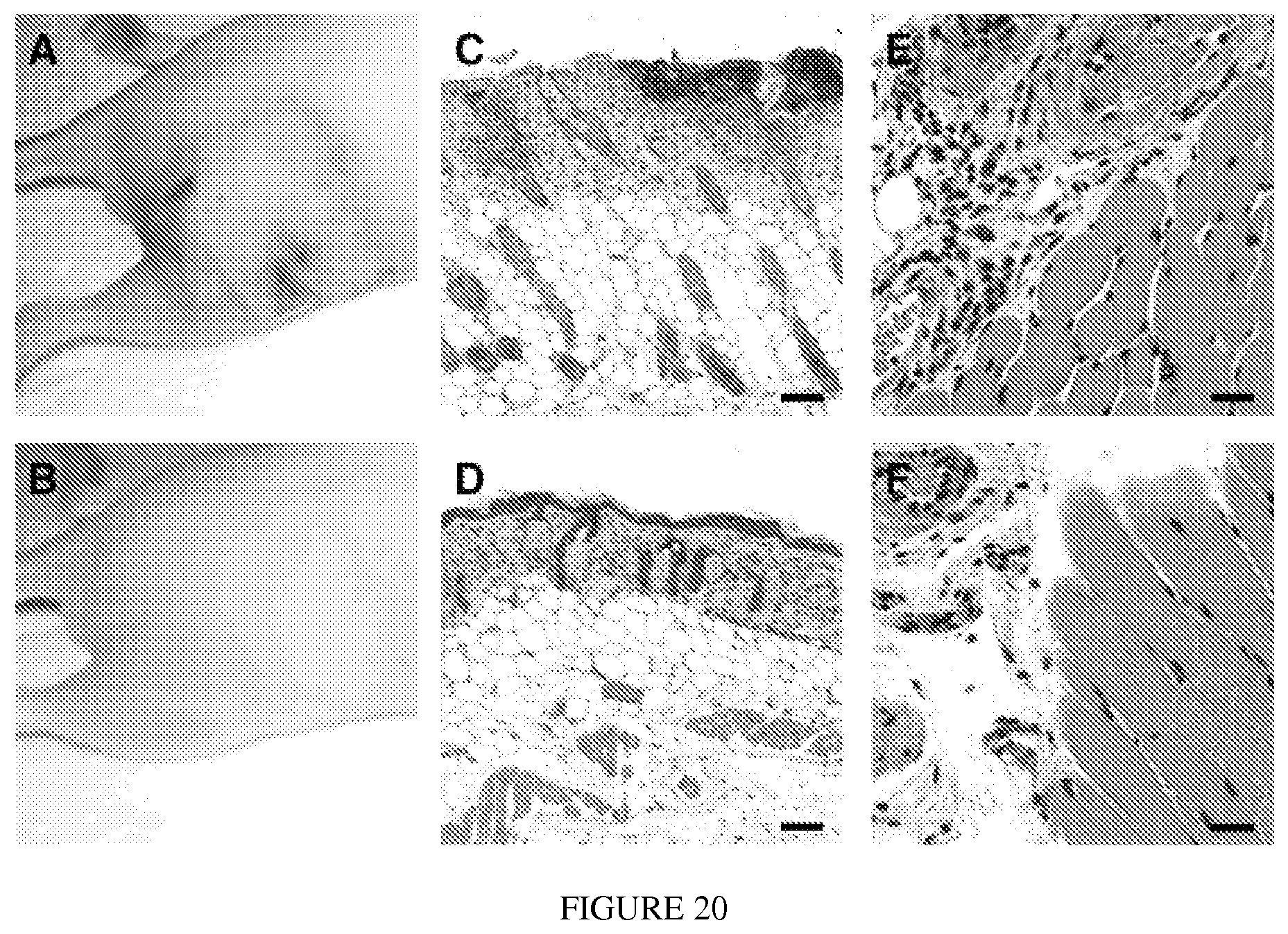 Patent US12097290 Figure 16 – Membrane encapsulated nanoparticles and method of use