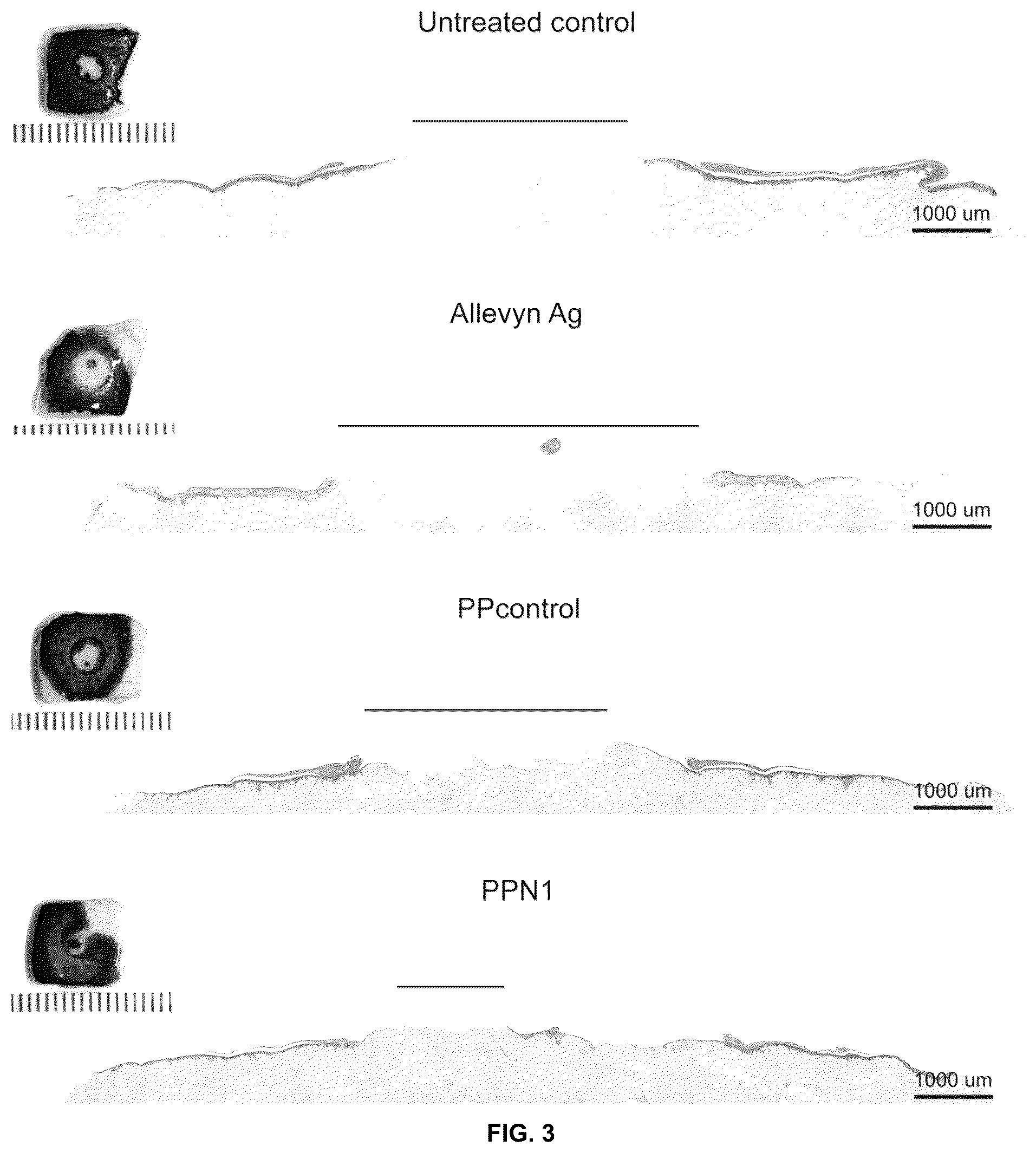 Patent US12097300 Figure 3 – Biofunctional hydrogel for wound healing