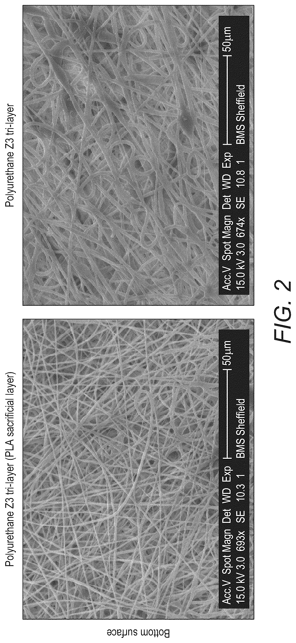 Patent US12097301 Figure 2 – Scaffold