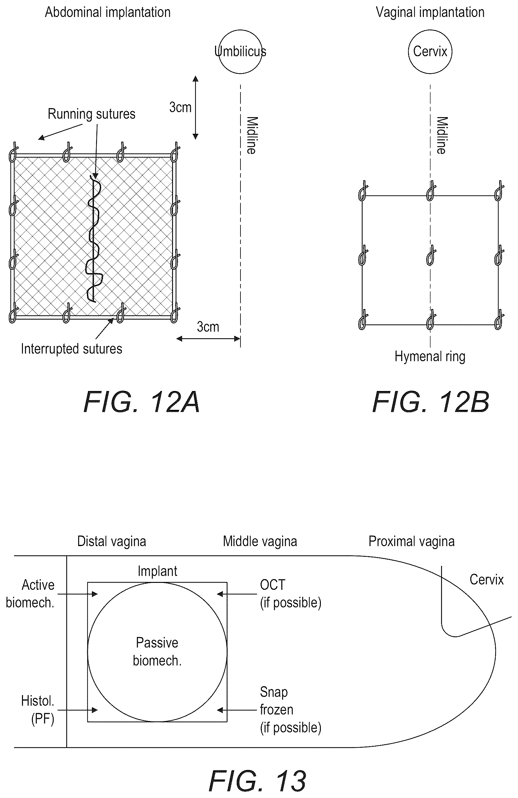 Patent US12097301 Figure 18 – Scaffold