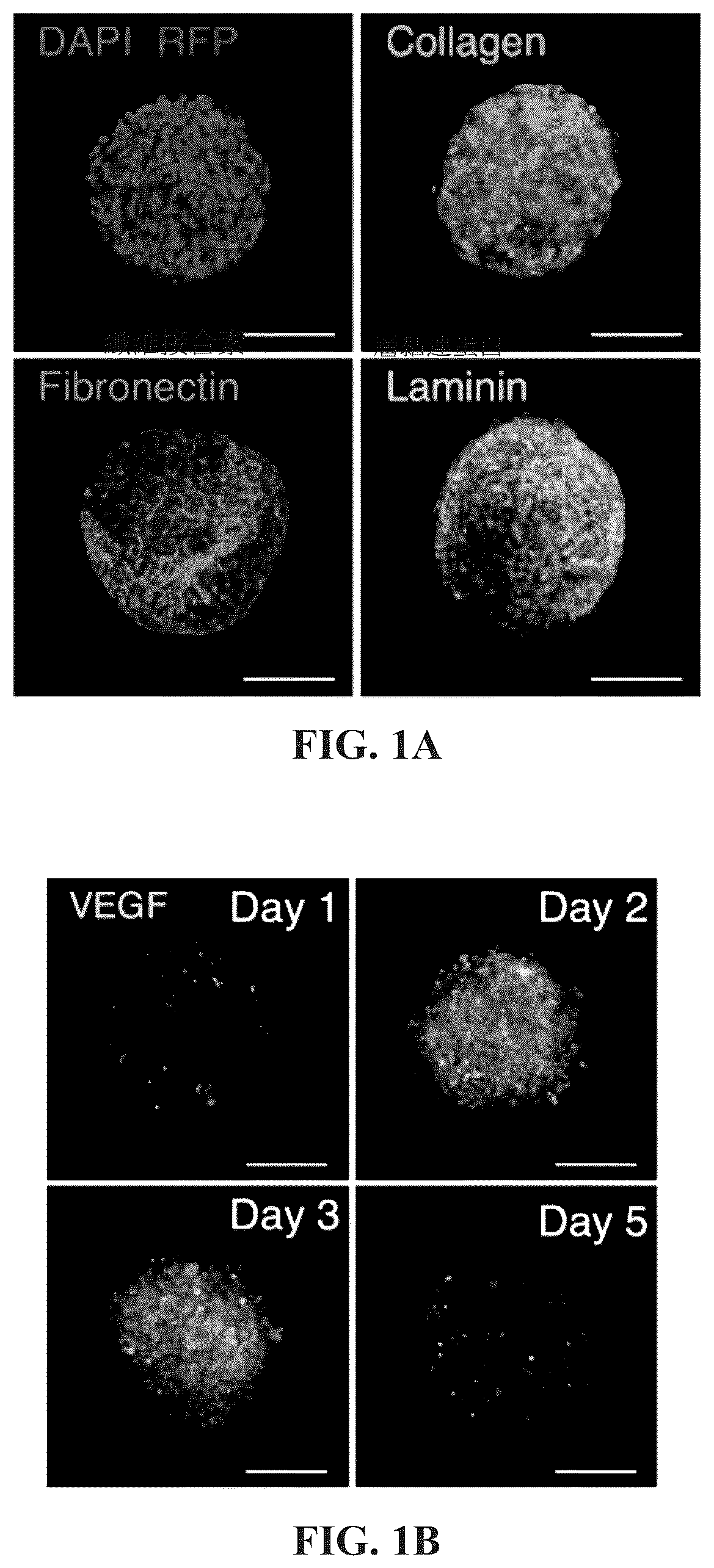Patent US12097303 Figure 1 – Decellularized extracellular matrix, preparation process and uses thereof