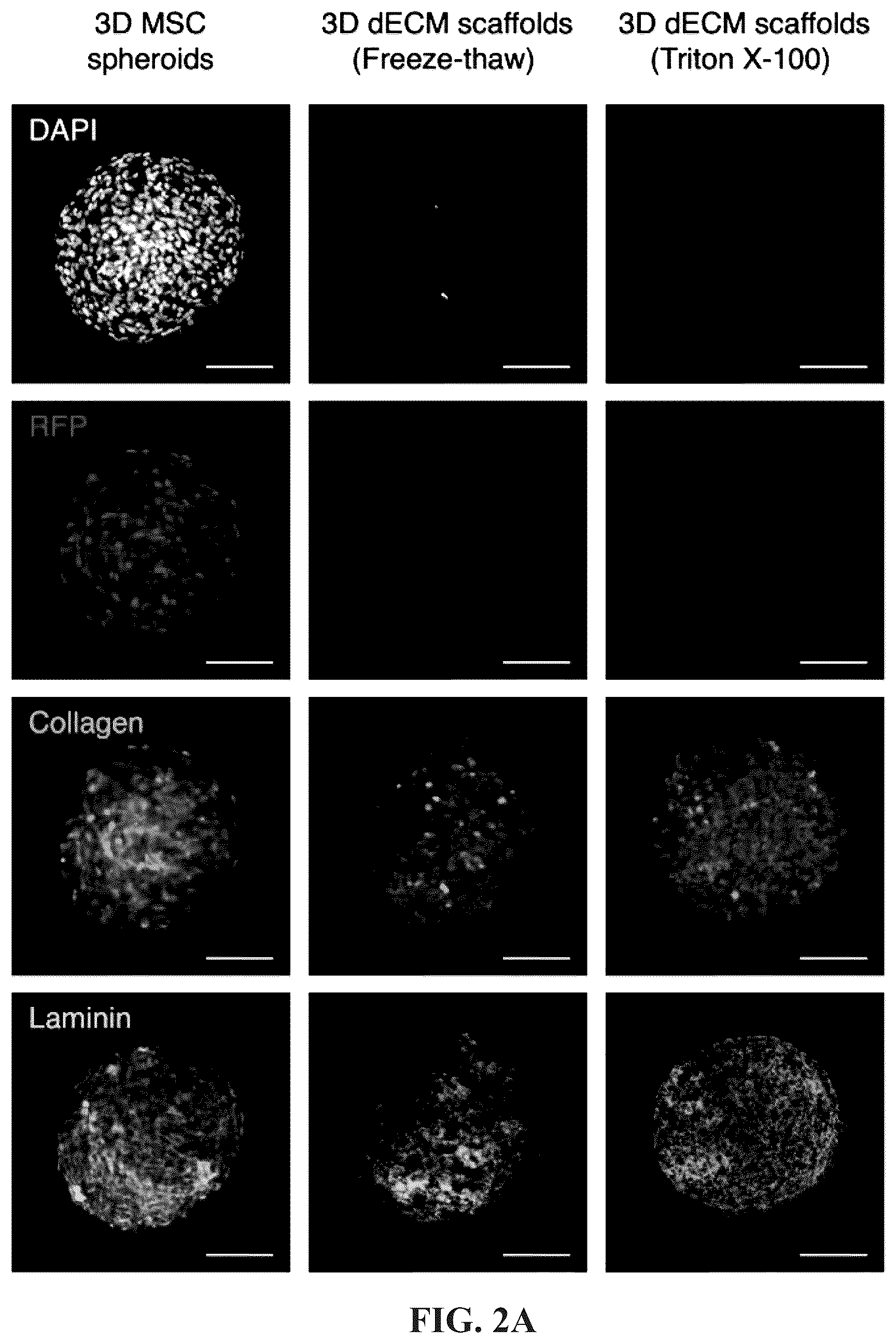 Patent US12097303 Figure 3 – Decellularized extracellular matrix, preparation process and uses thereof