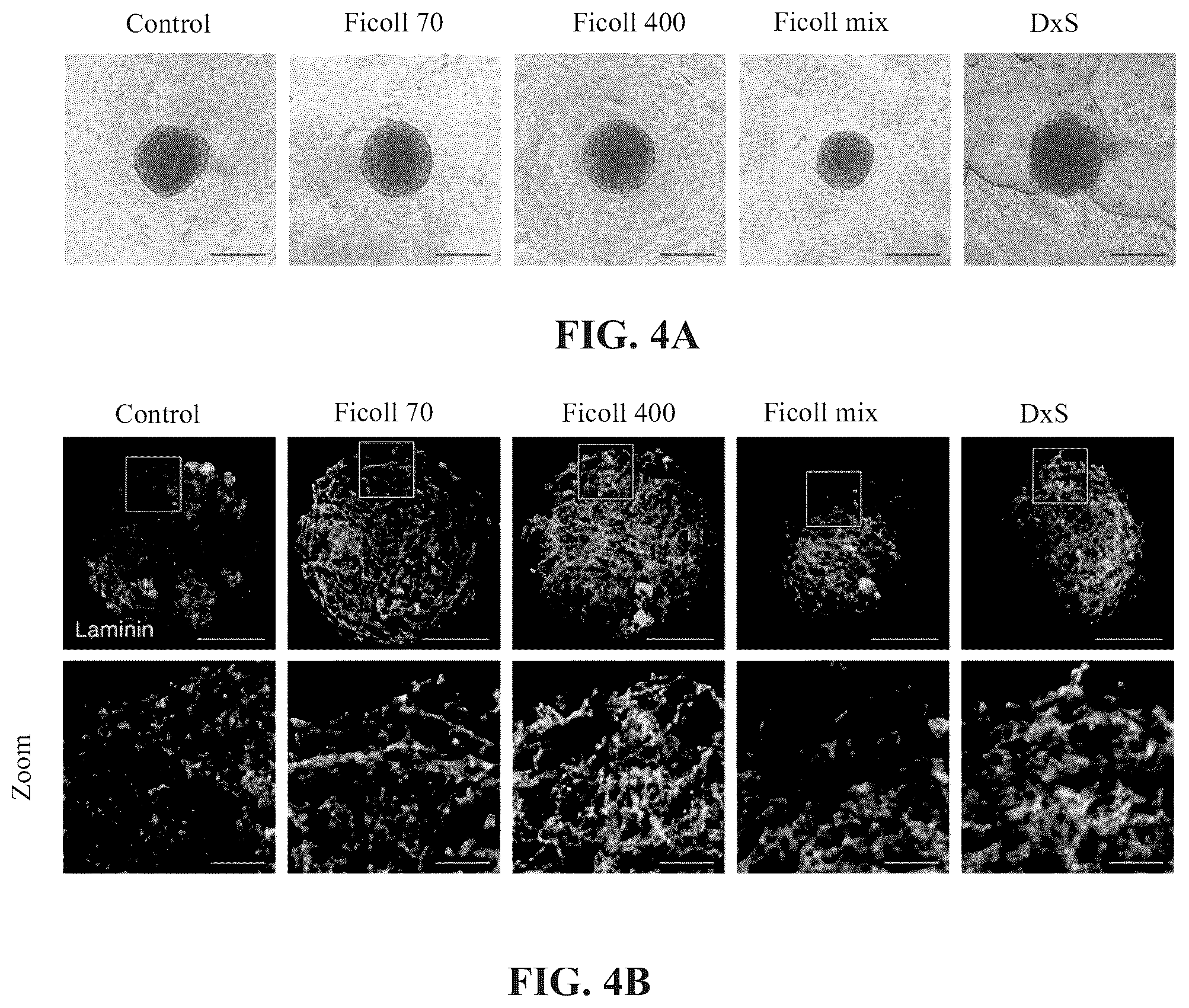 Patent US12097303 Figure 6 – Decellularized extracellular matrix, preparation process and uses thereof